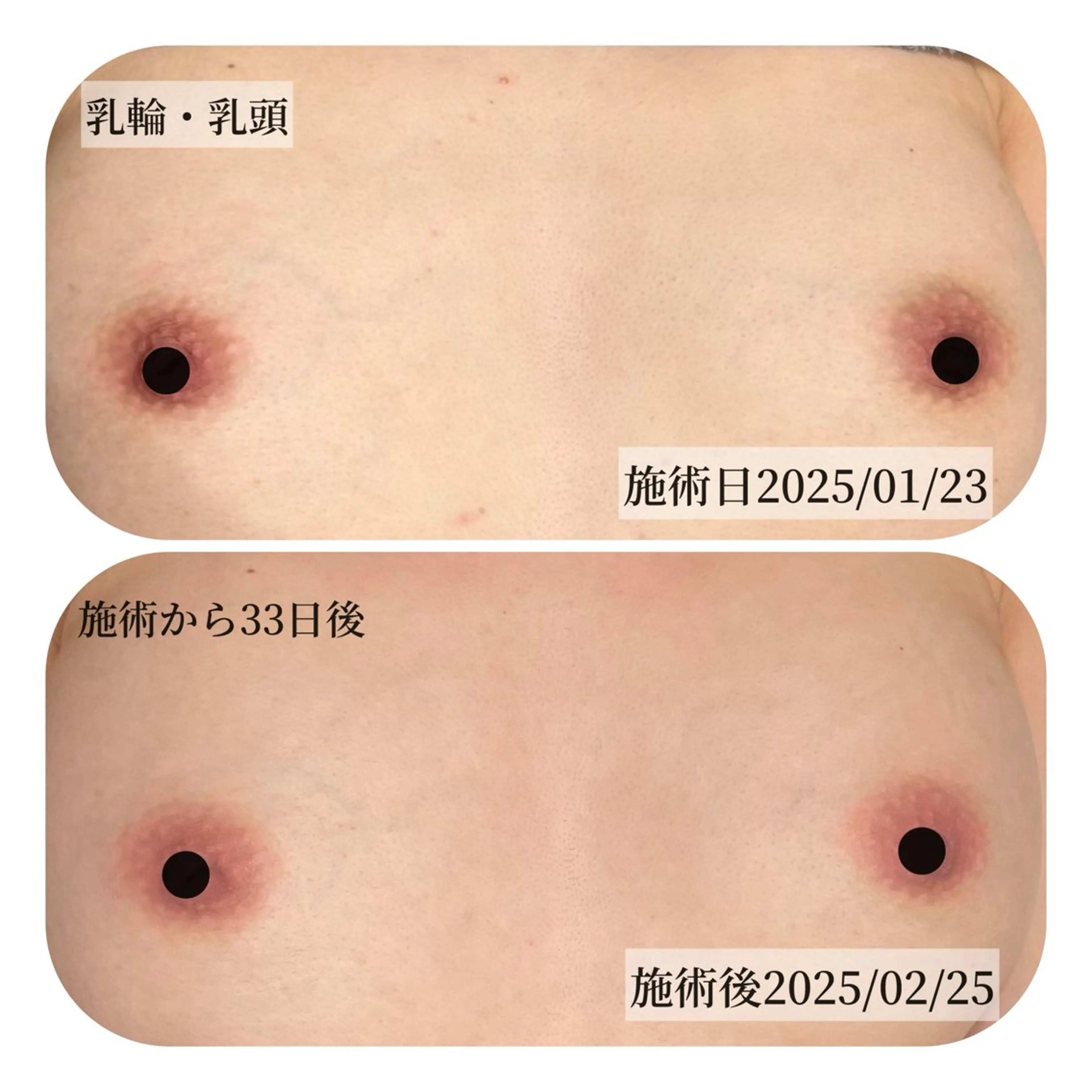 その他 Salon ALLIUM 恵比寿のエステ・リラクイメージ