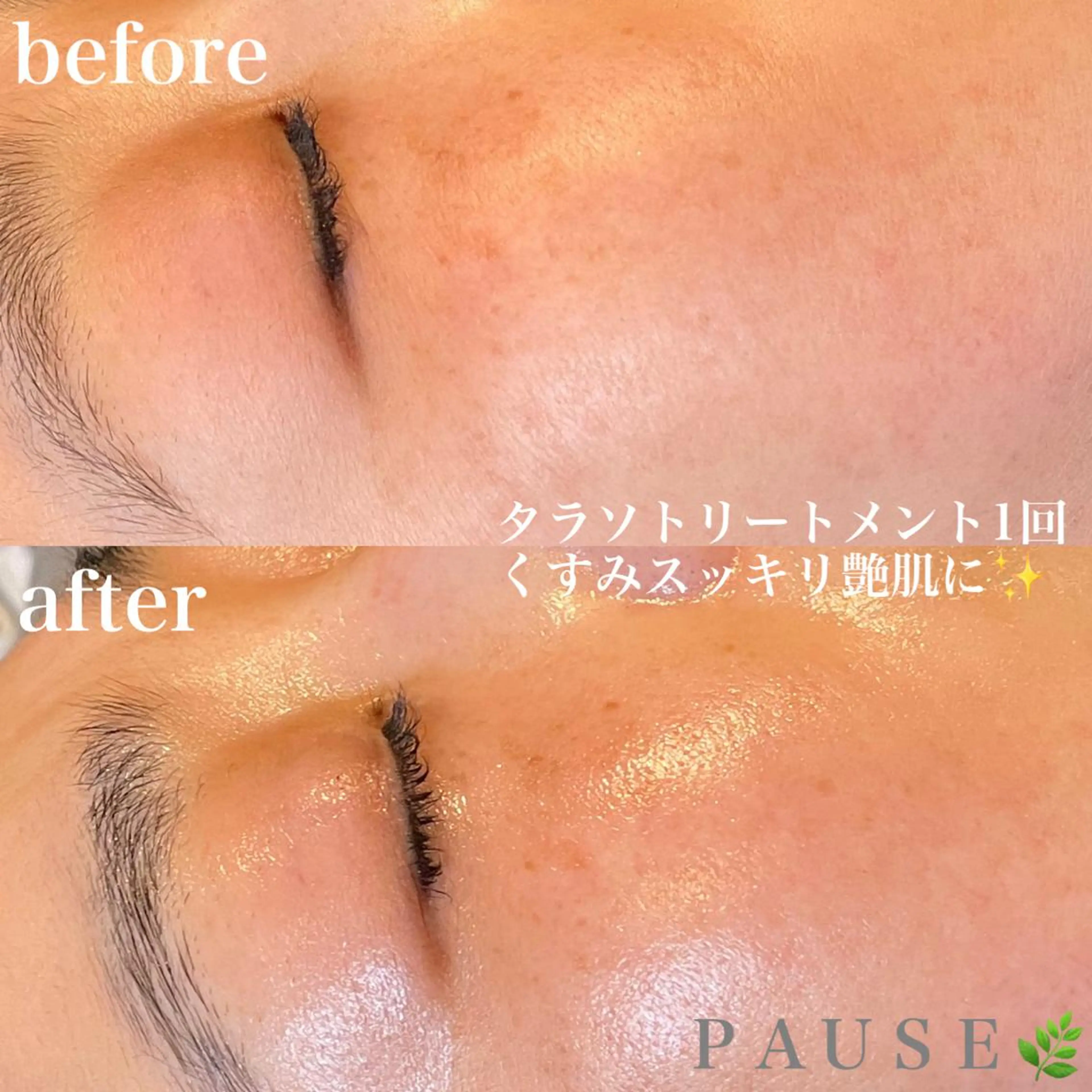 エステ 浜野 恵美のエステ・リラクイメージ