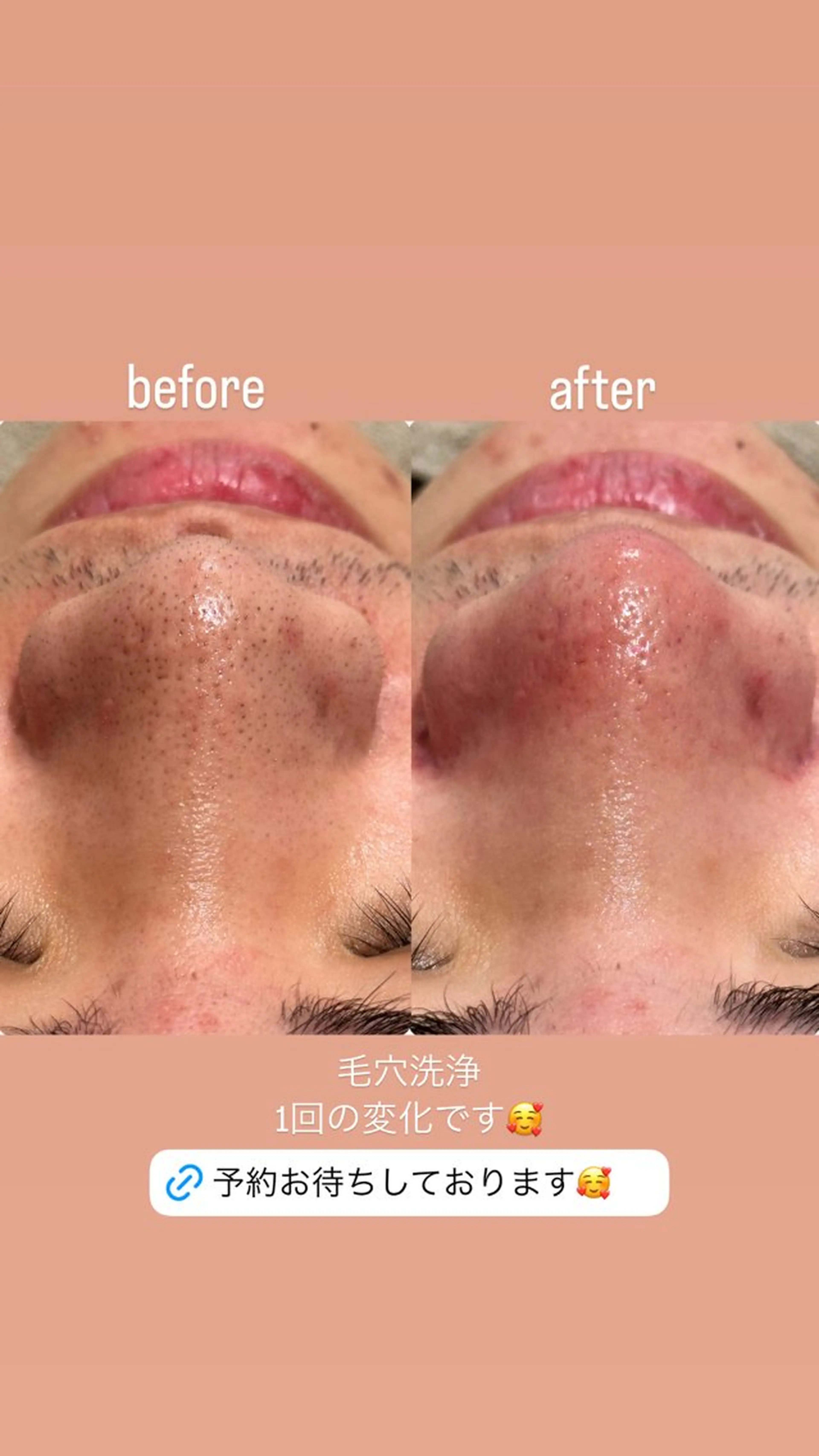 エステ mumu beautyのエステ・リラクイメージ