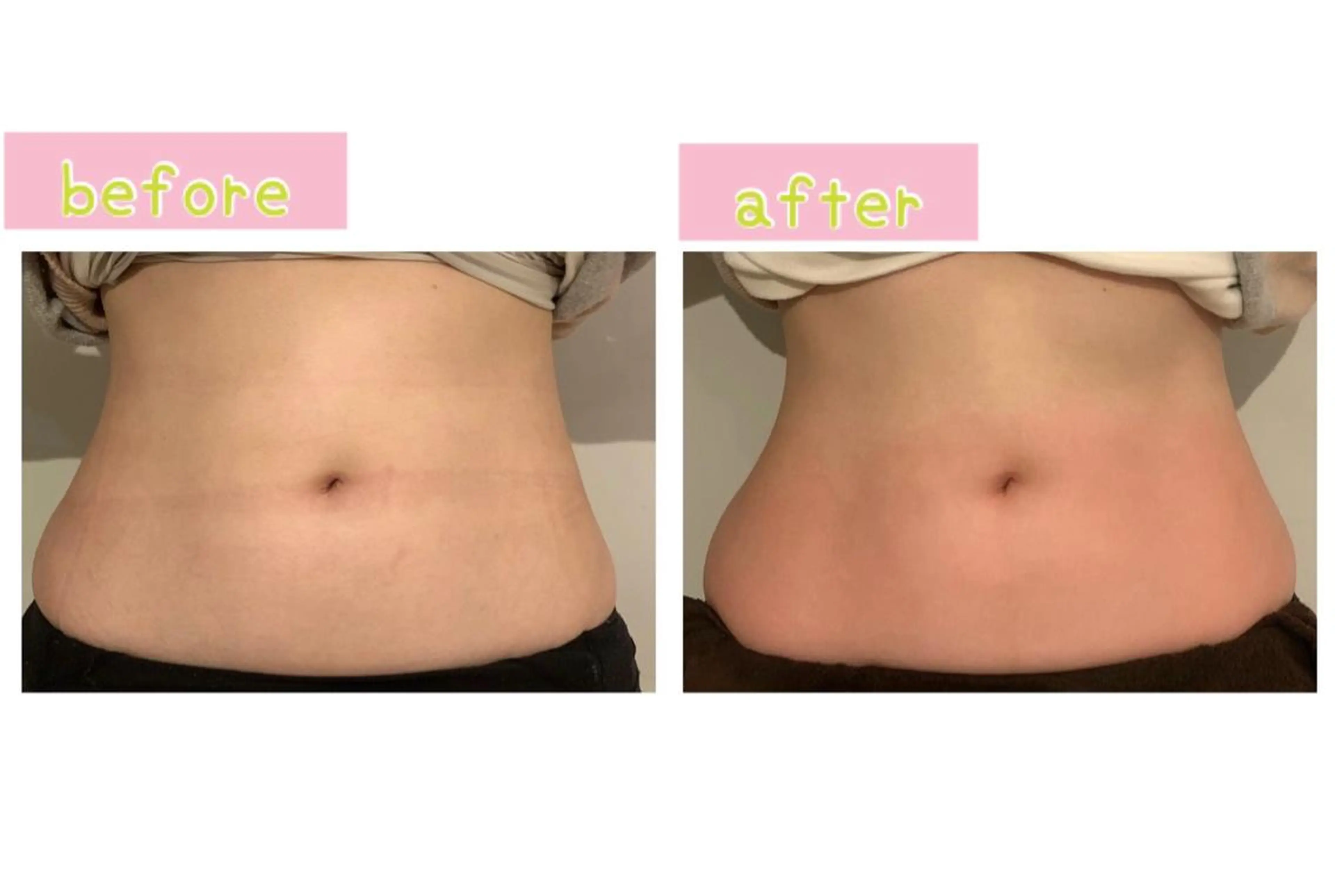 エステ 癒し腸もみサロン シャユーム　ゆきなのエステ・リラクイメージ