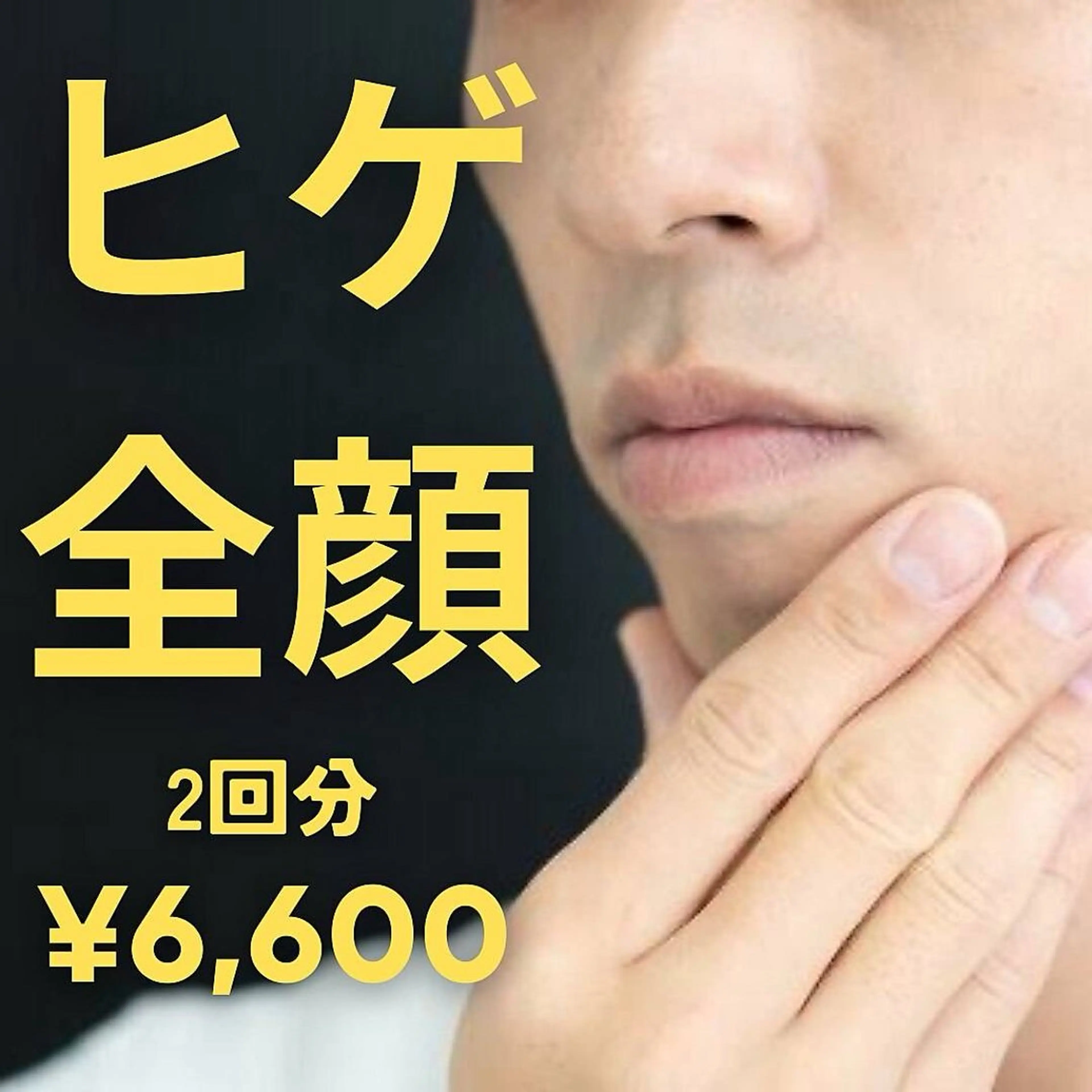 ヒゲ全顔脱毛2回分　¥22000→¥6600の写真