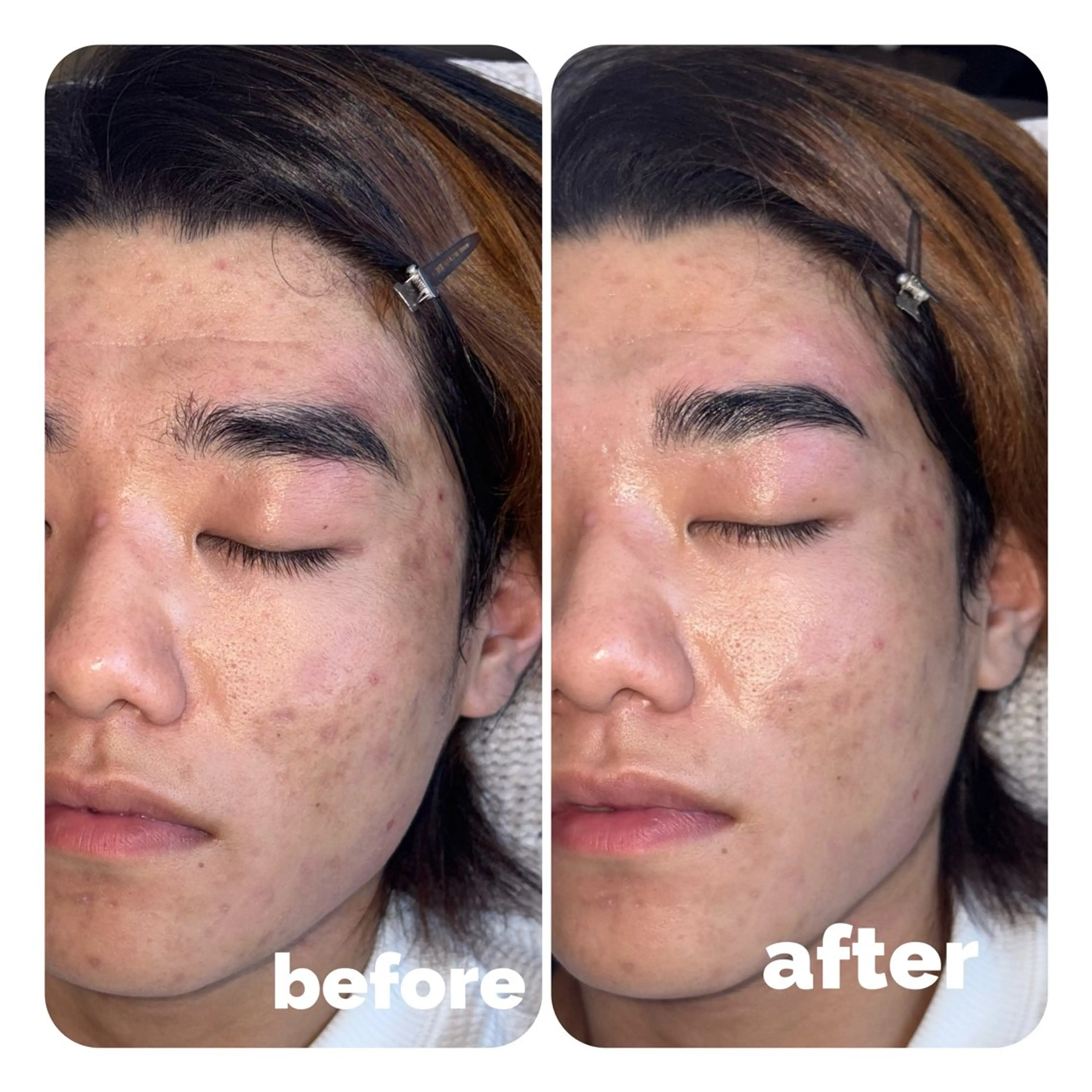 アイブロウ ハリウッドブロウリフト メンズアイブロウ 眉毛ワックス脱毛 ワックス脱毛 その他(アイブロウ) LAND🫧🎀 Ayakaの眉毛・アイブロウイメージ