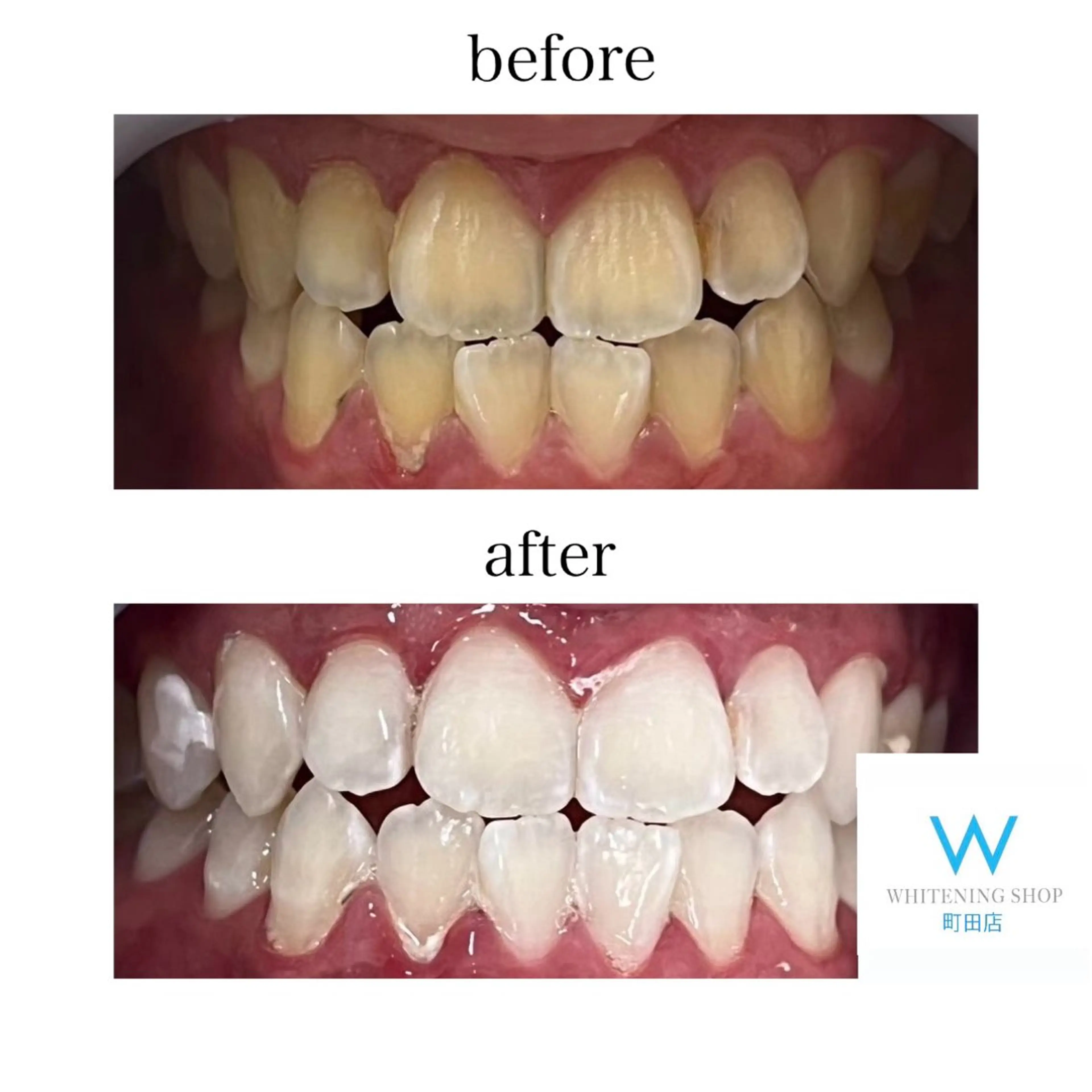 メンズ キッズ その他 ホワイトニング ショップ町田店のその他イメージ