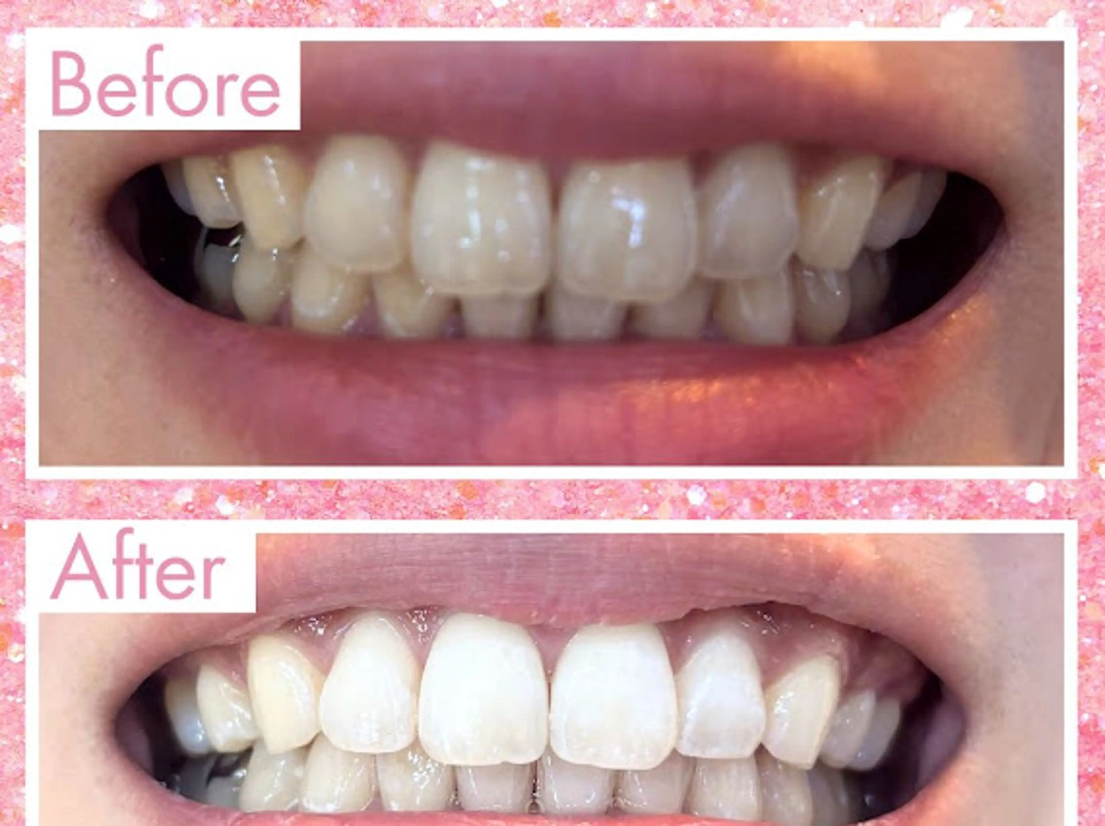 その他 エクシアホワイト姫路店所属・浦野 希悠のその他イメージ