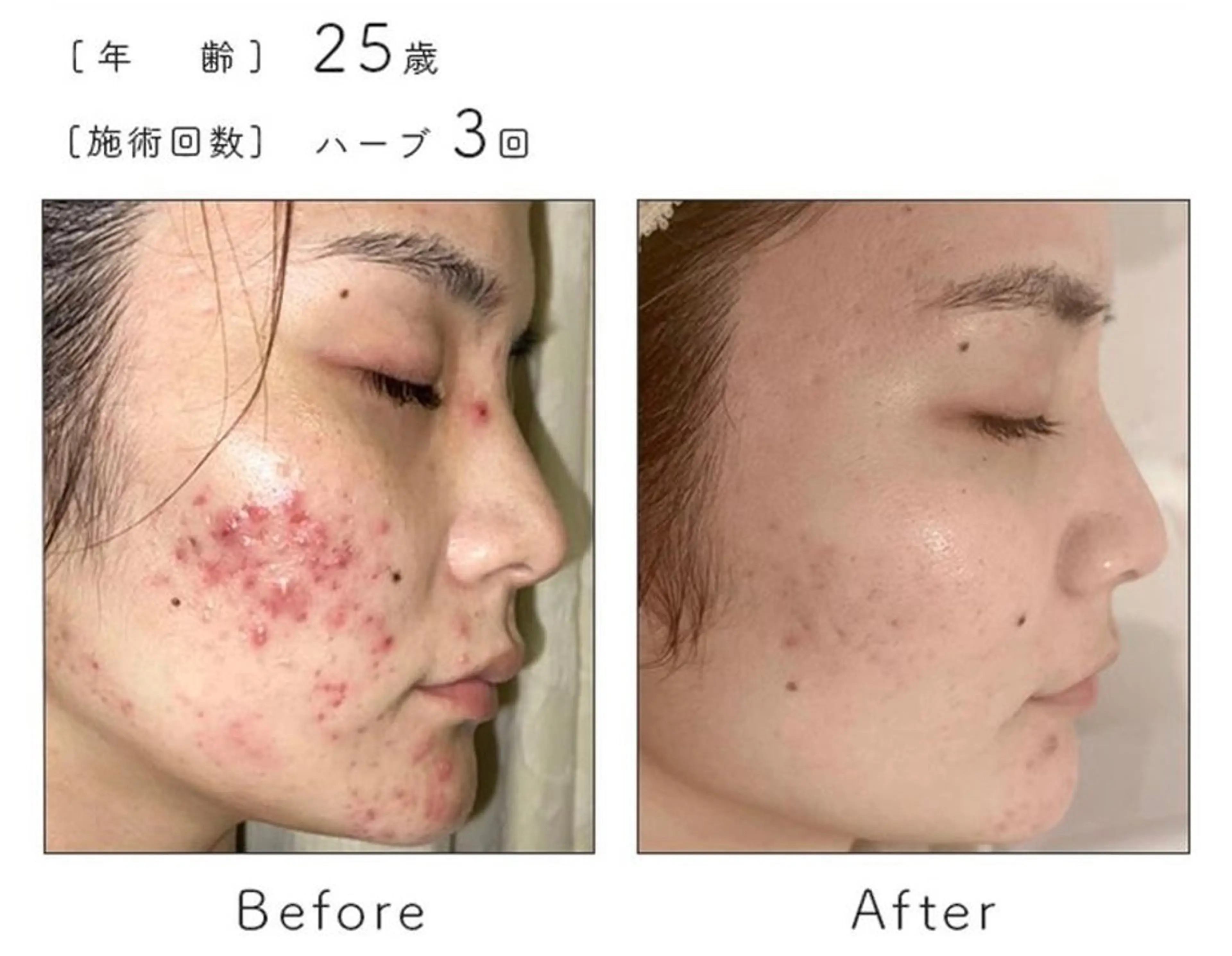 エステ ハーブピーリング専門 BIOEL横浜のエステ・リラクイメージ