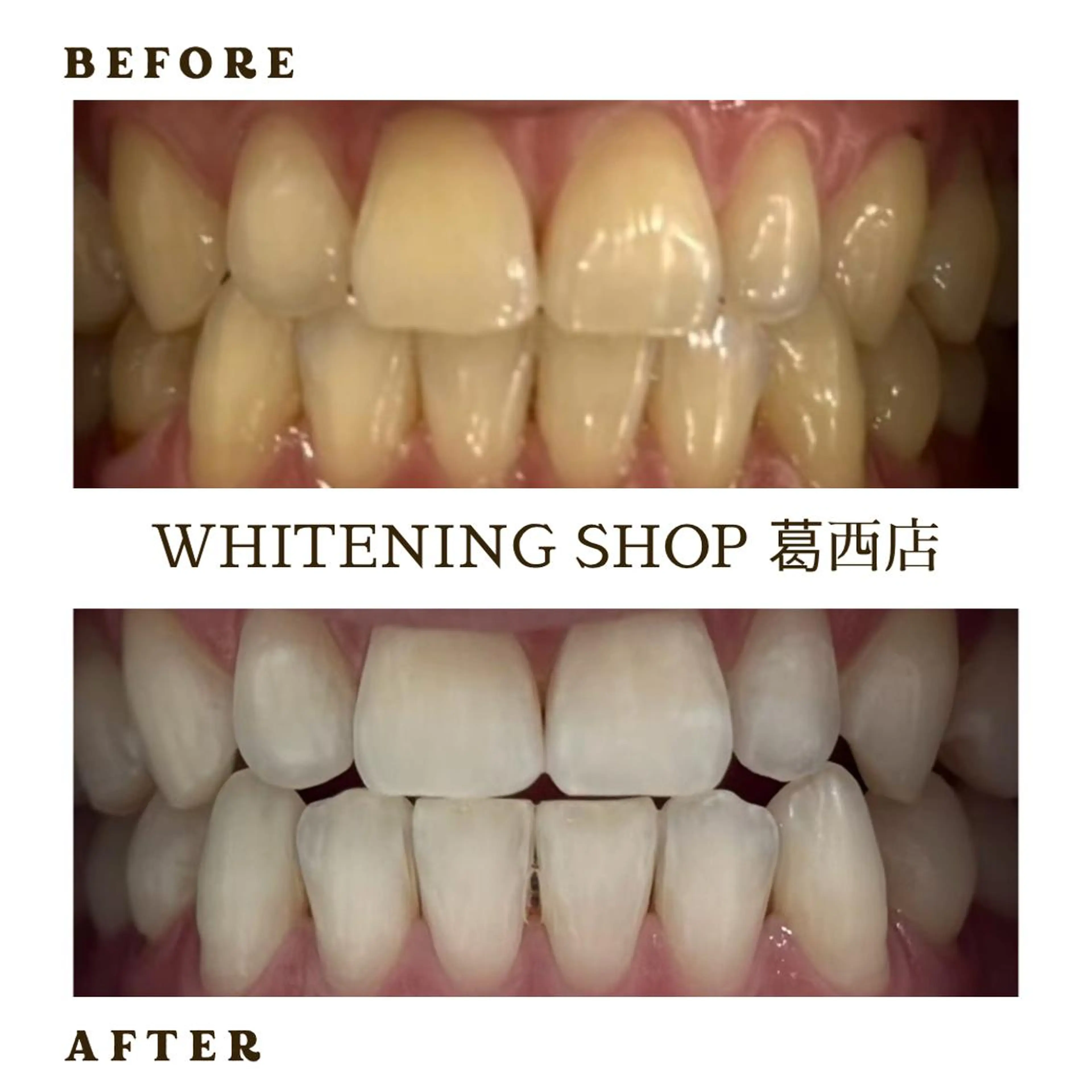 メンズ その他 ホワイトニング ショップ葛西店のその他イメージ