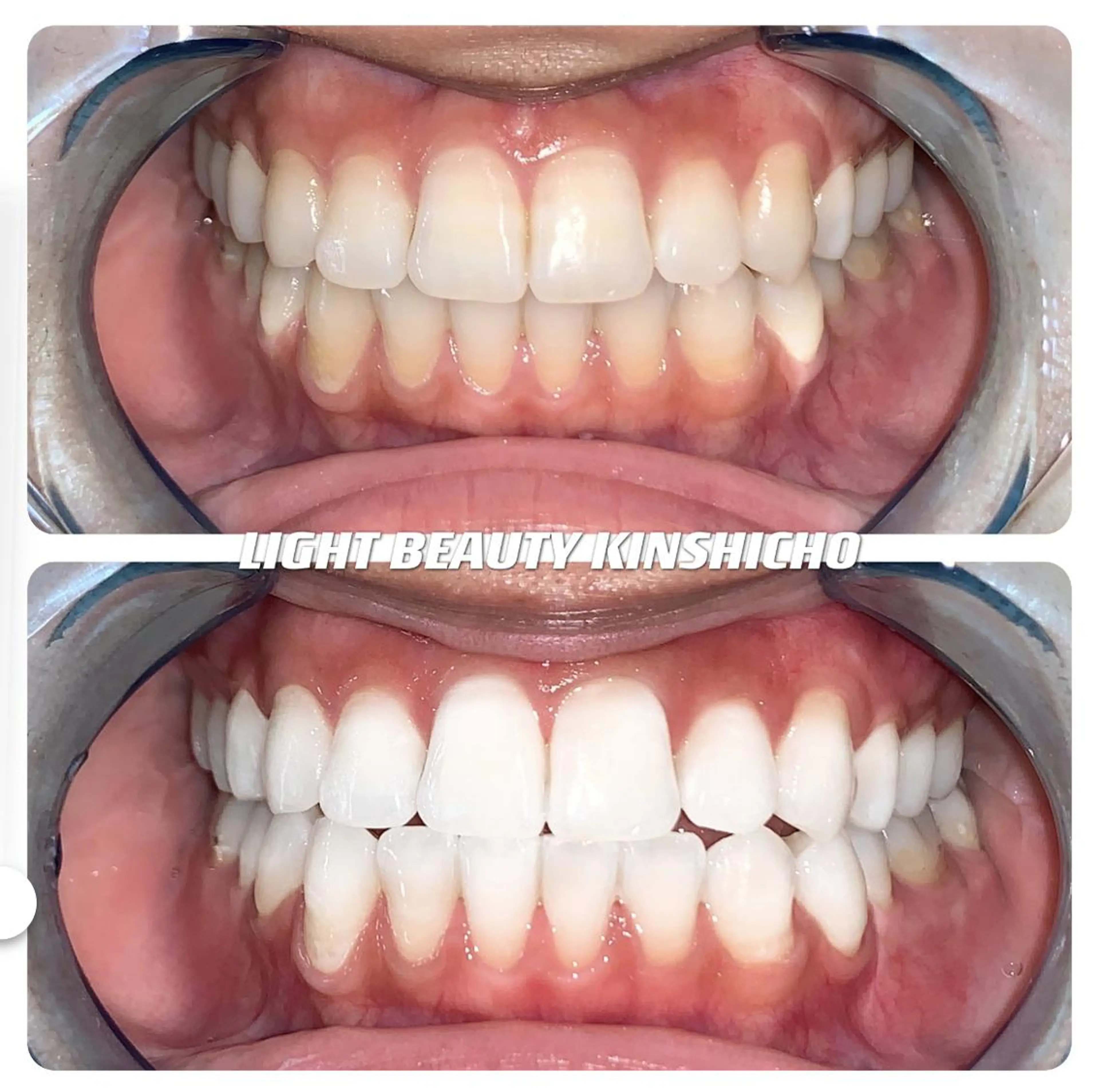 メンズ ライトビューティー 錦糸町店のエステ・リラクイメージ