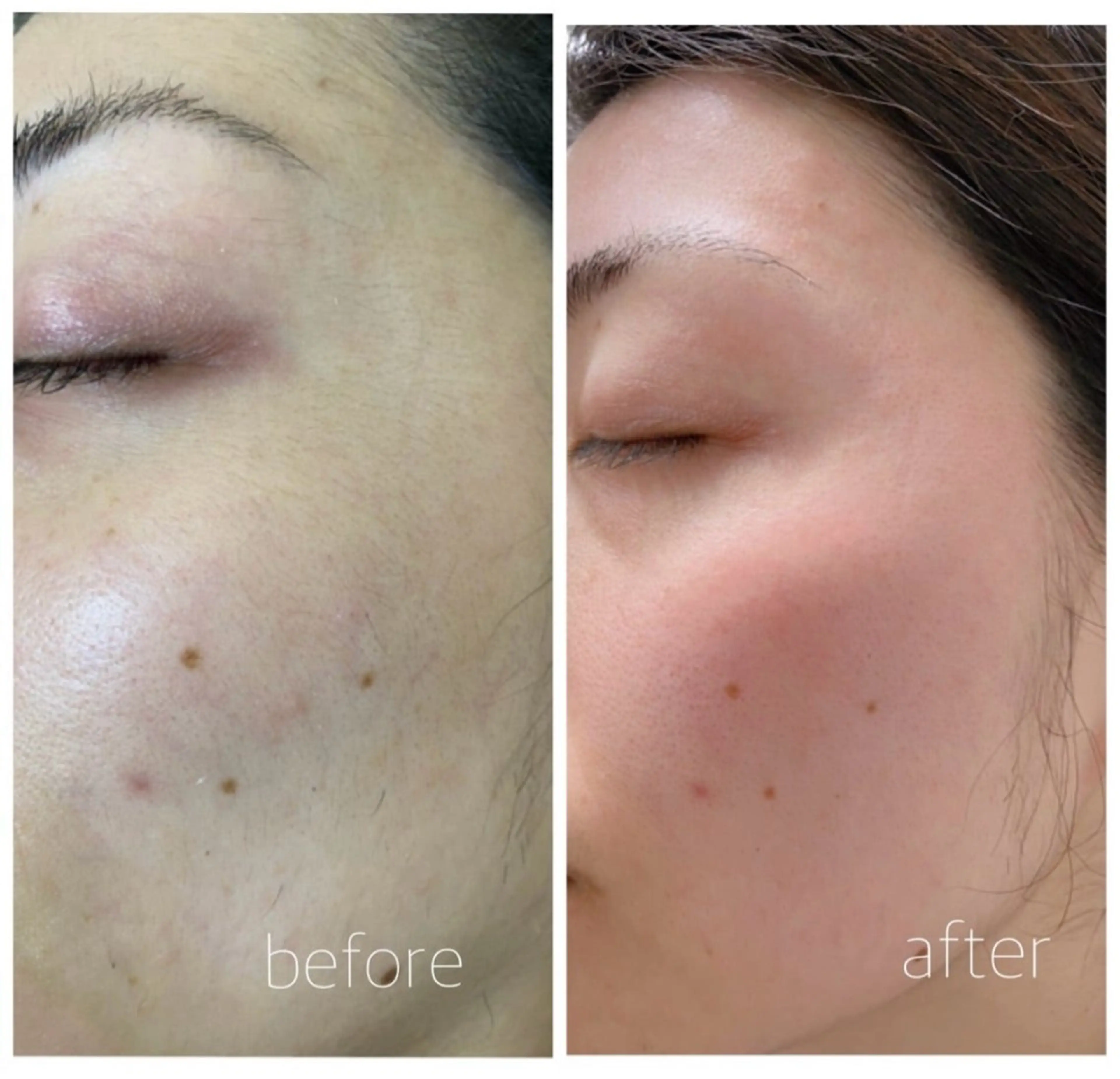 Lala Beautyのエステ・リラクイメージ