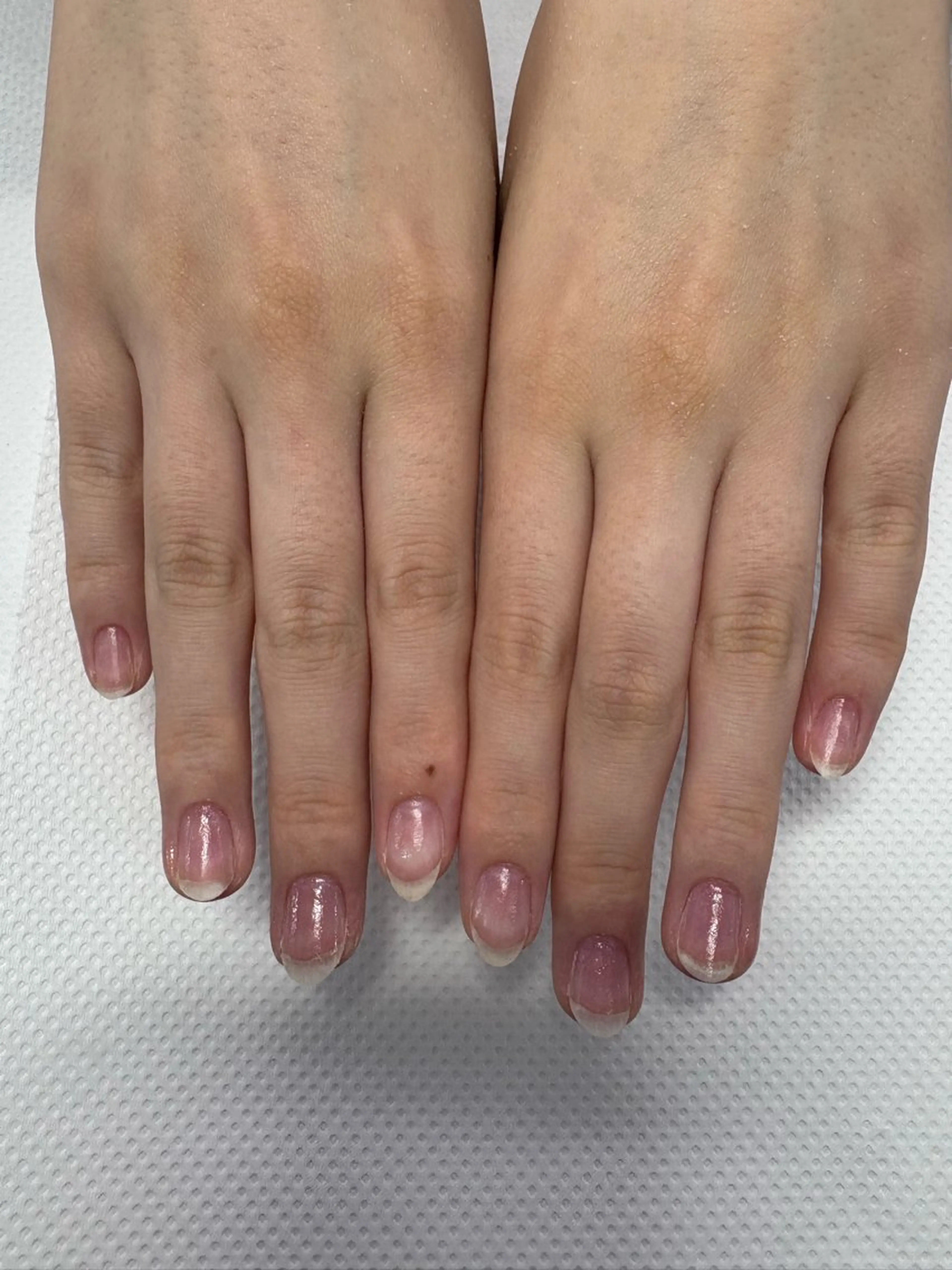 ネイル 楠本 琴音のネイルデザイン