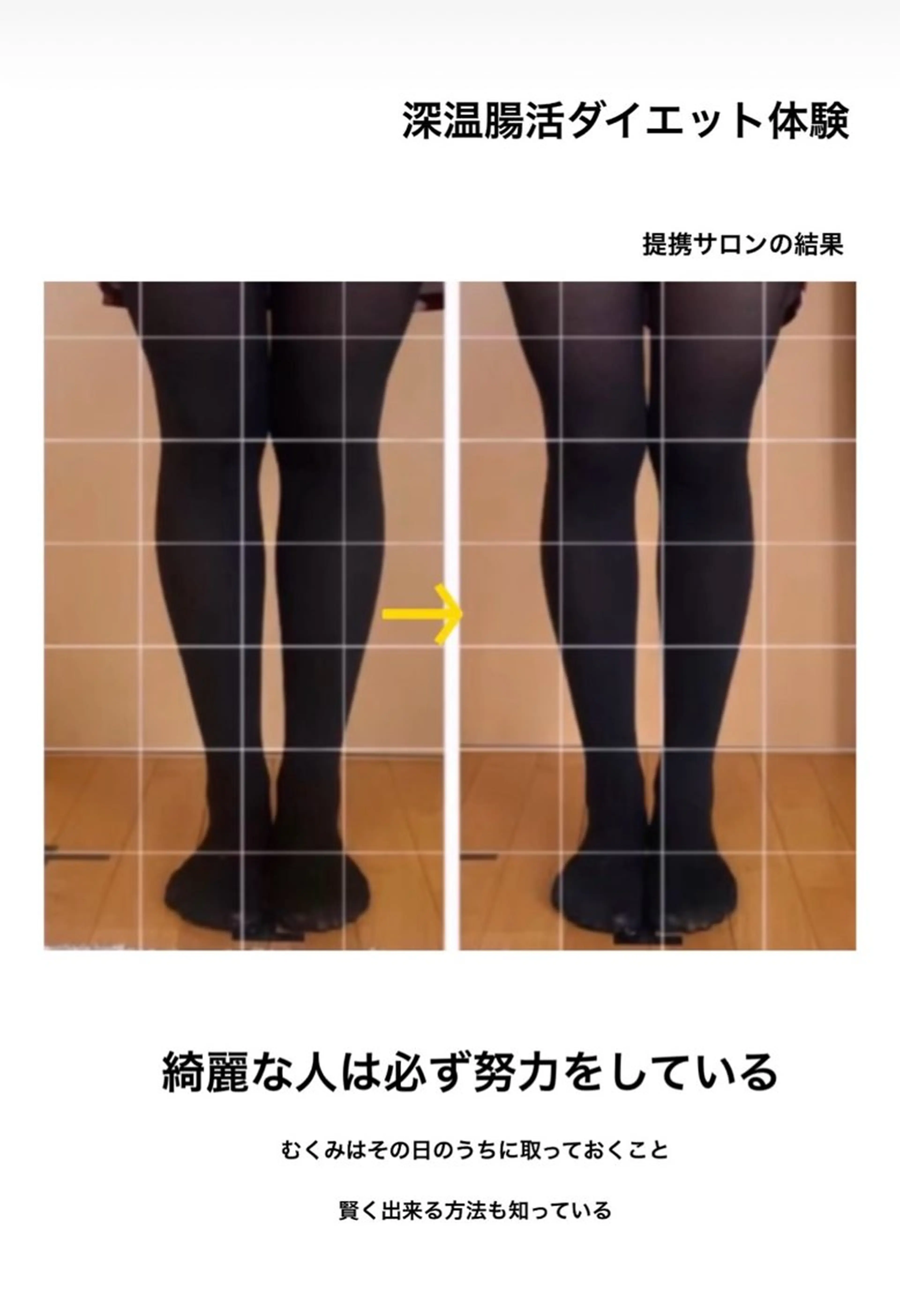 luana-ルアナ-所属・最高に輝く花嫁姿へ ブライダルsaronのエステ・リラクイメージ