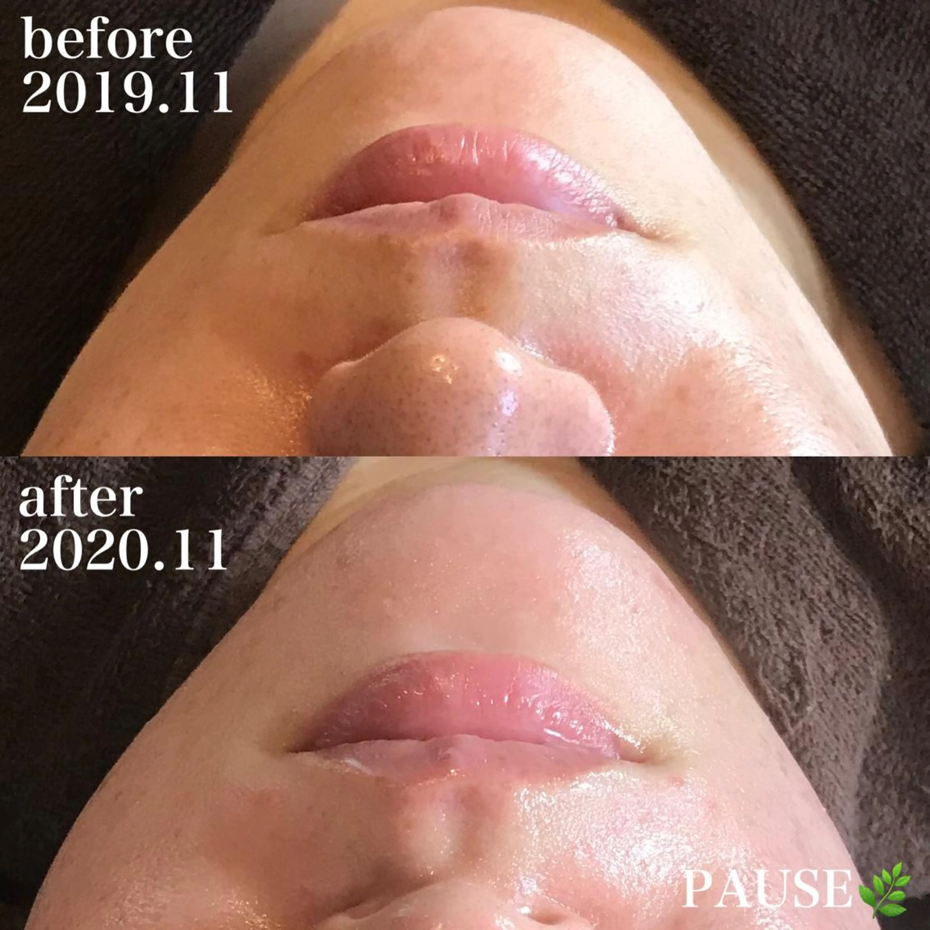 エステ 浜野 恵美のエステ・リラクイメージ