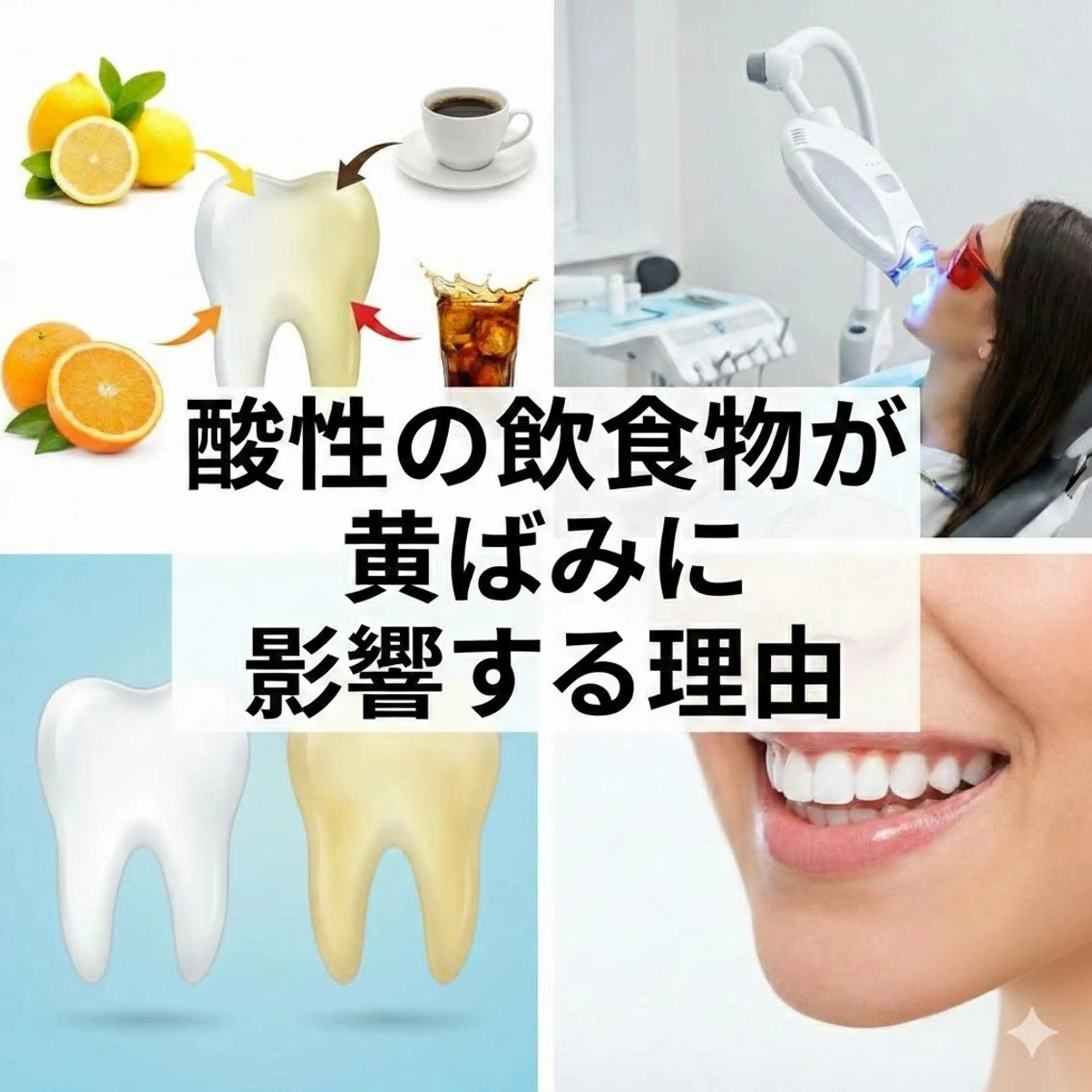 ネイル ホワイト その他 ホワイトニングサロン nico西葛西店のその他イメージ