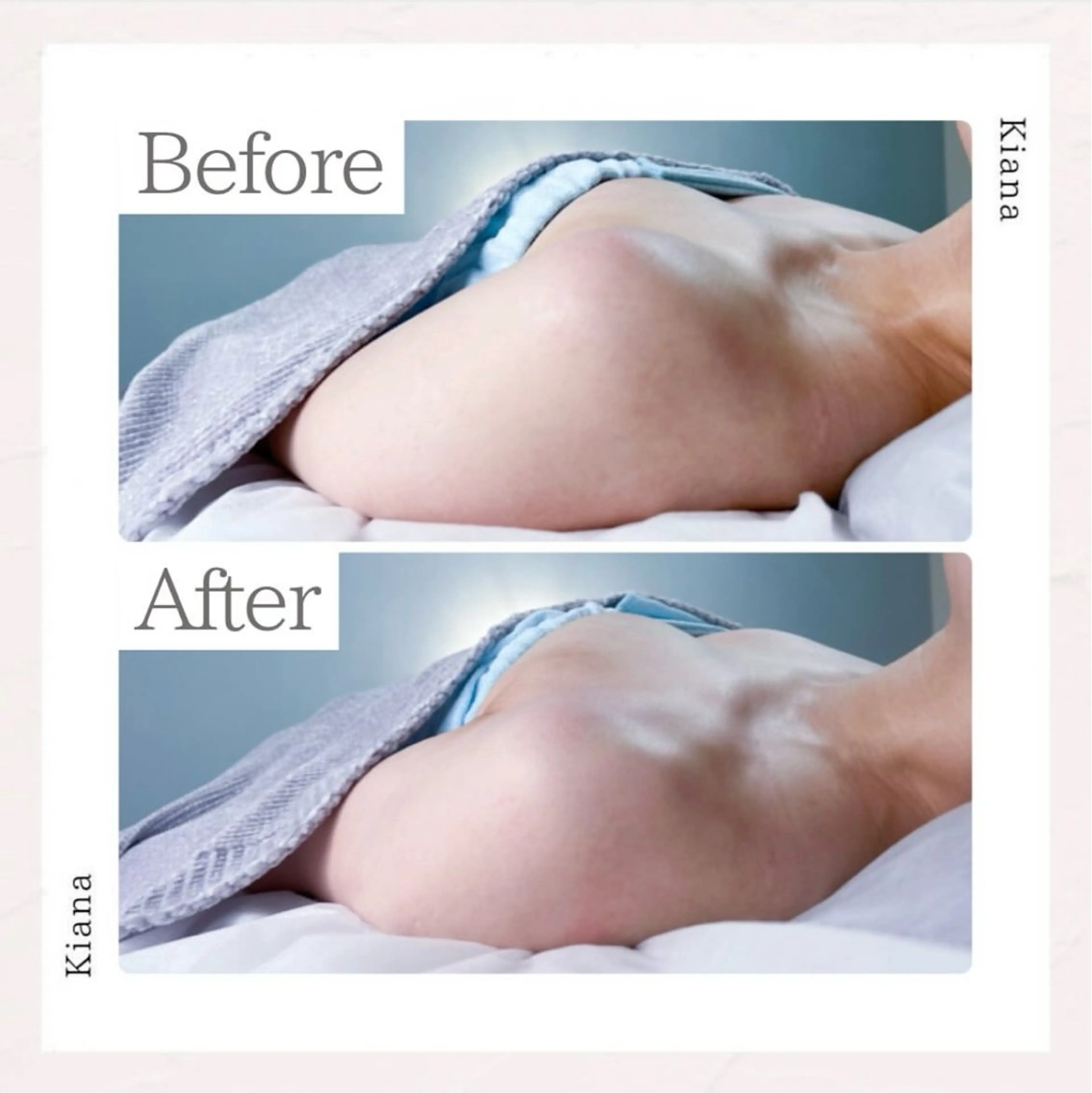 バスト専門Kiana 風のエステ・リラクイメージ