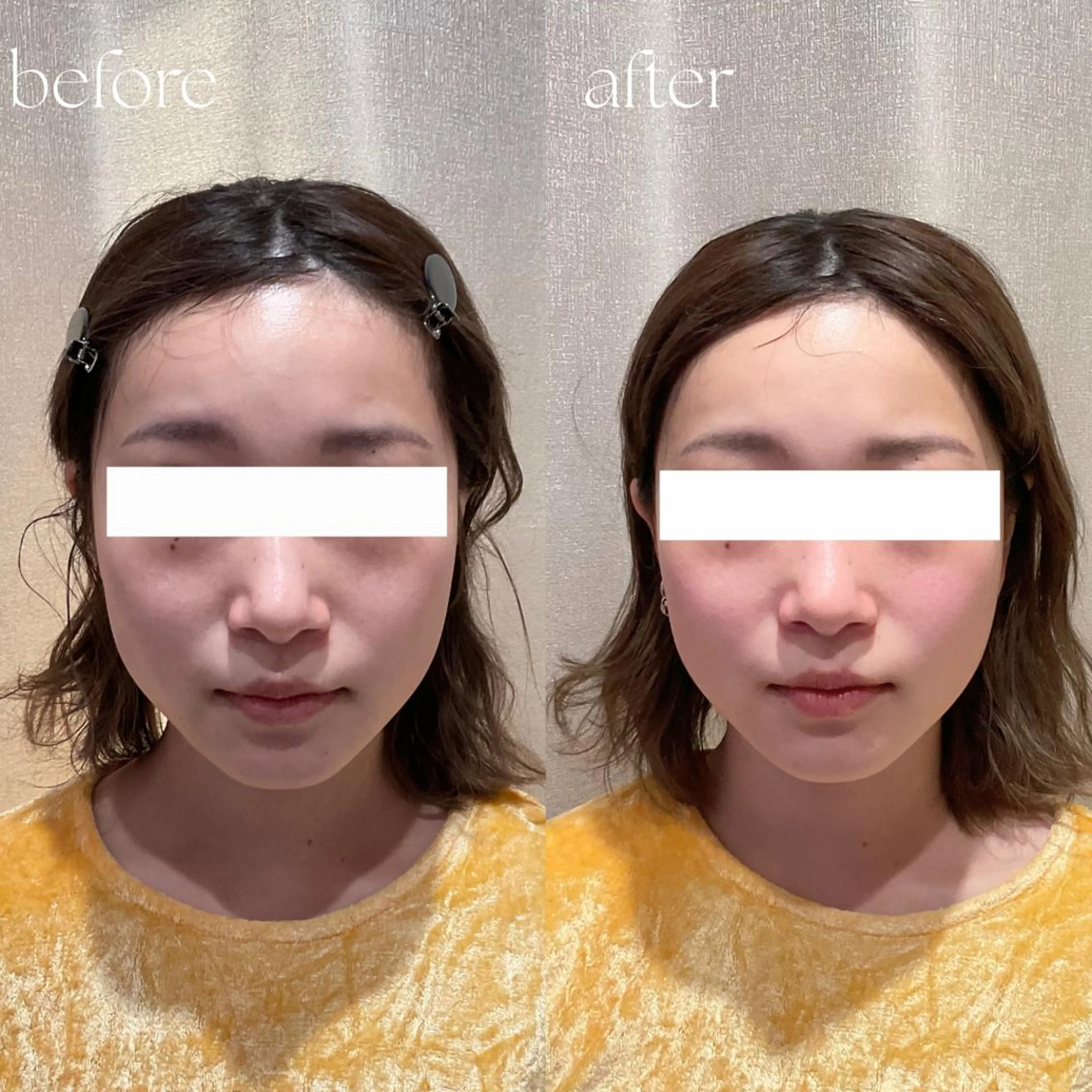 エステ リラク B-st. 下北沢のエステ・リラクイメージ