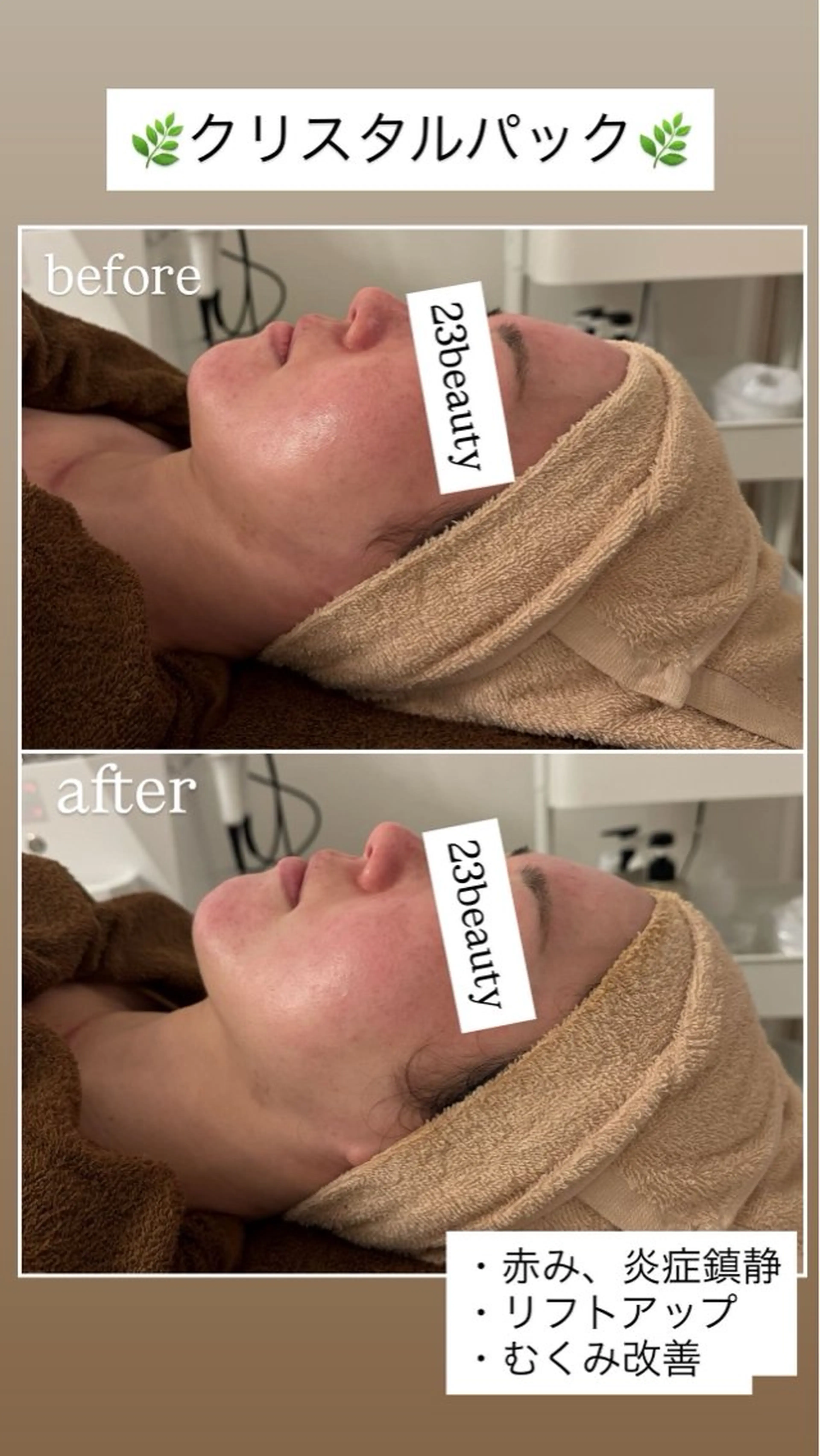 エステ 23beauty所属・武藤 那月のエステ・リラクイメージ