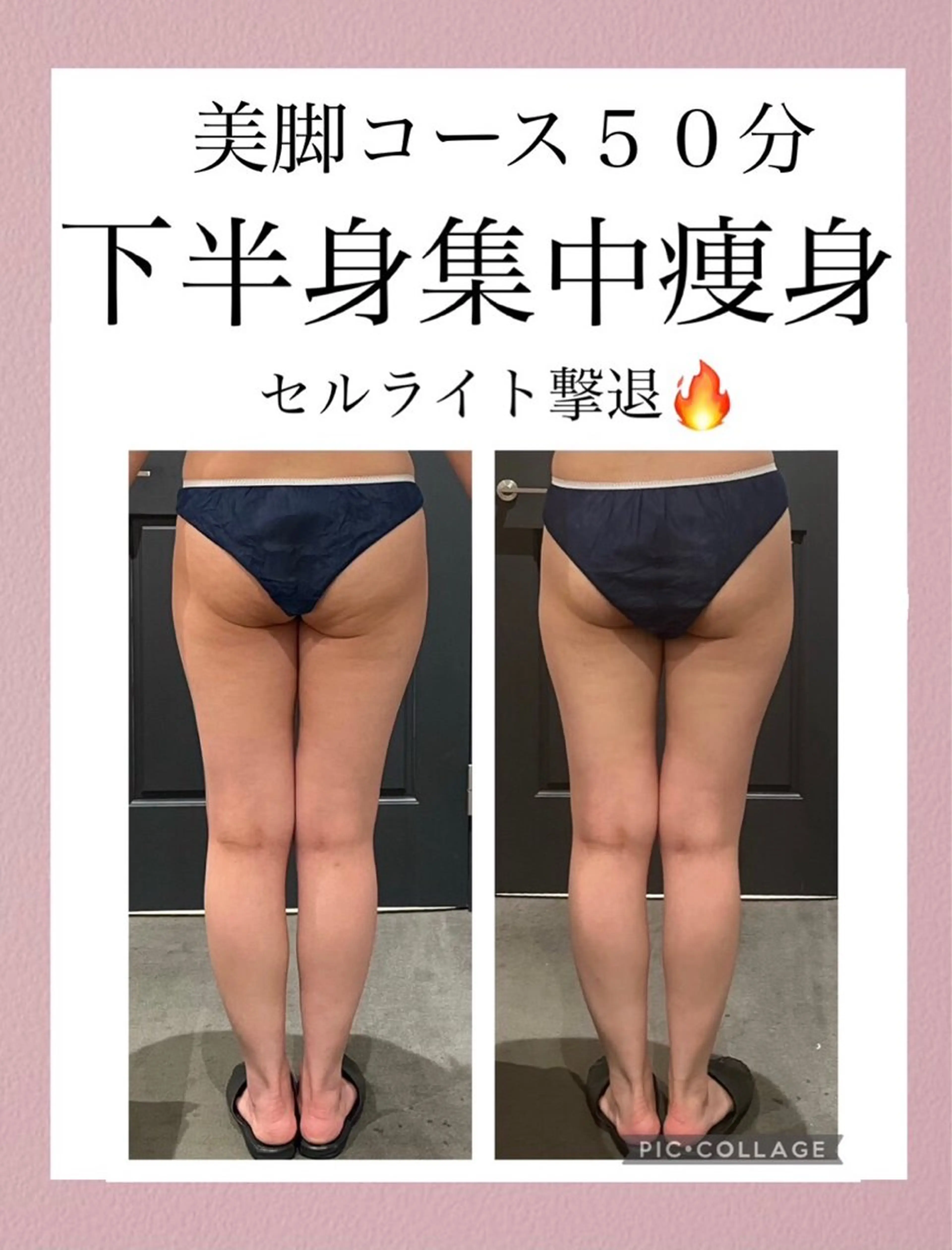 【初回限定】痛いからこそ効く頑固なセルライトとさよなら、脚痩せ50分コース⭐︎の写真