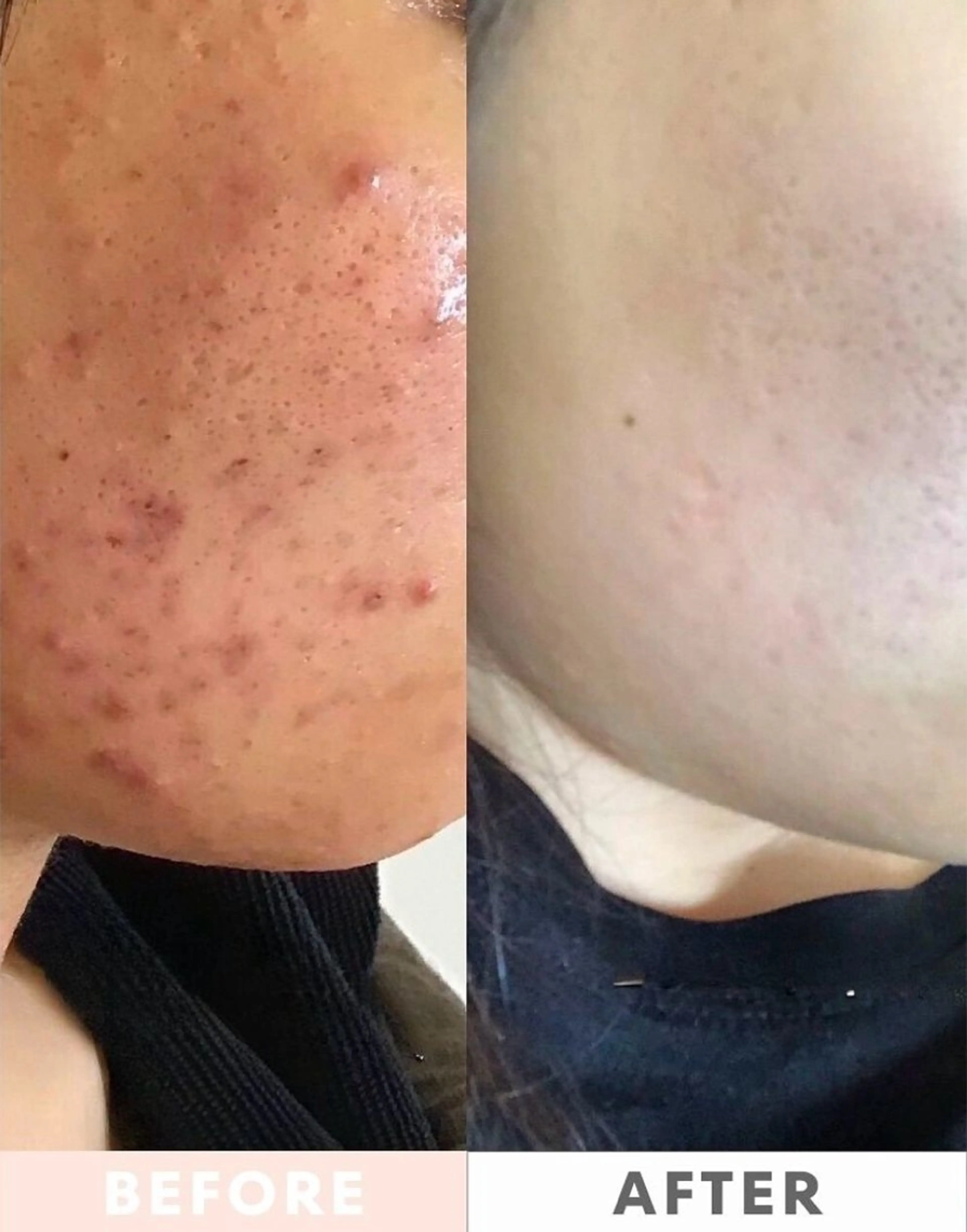 M.plus所属・水光韓国肌ハーブ ピーリングMplusのエステ・リラクイメージ