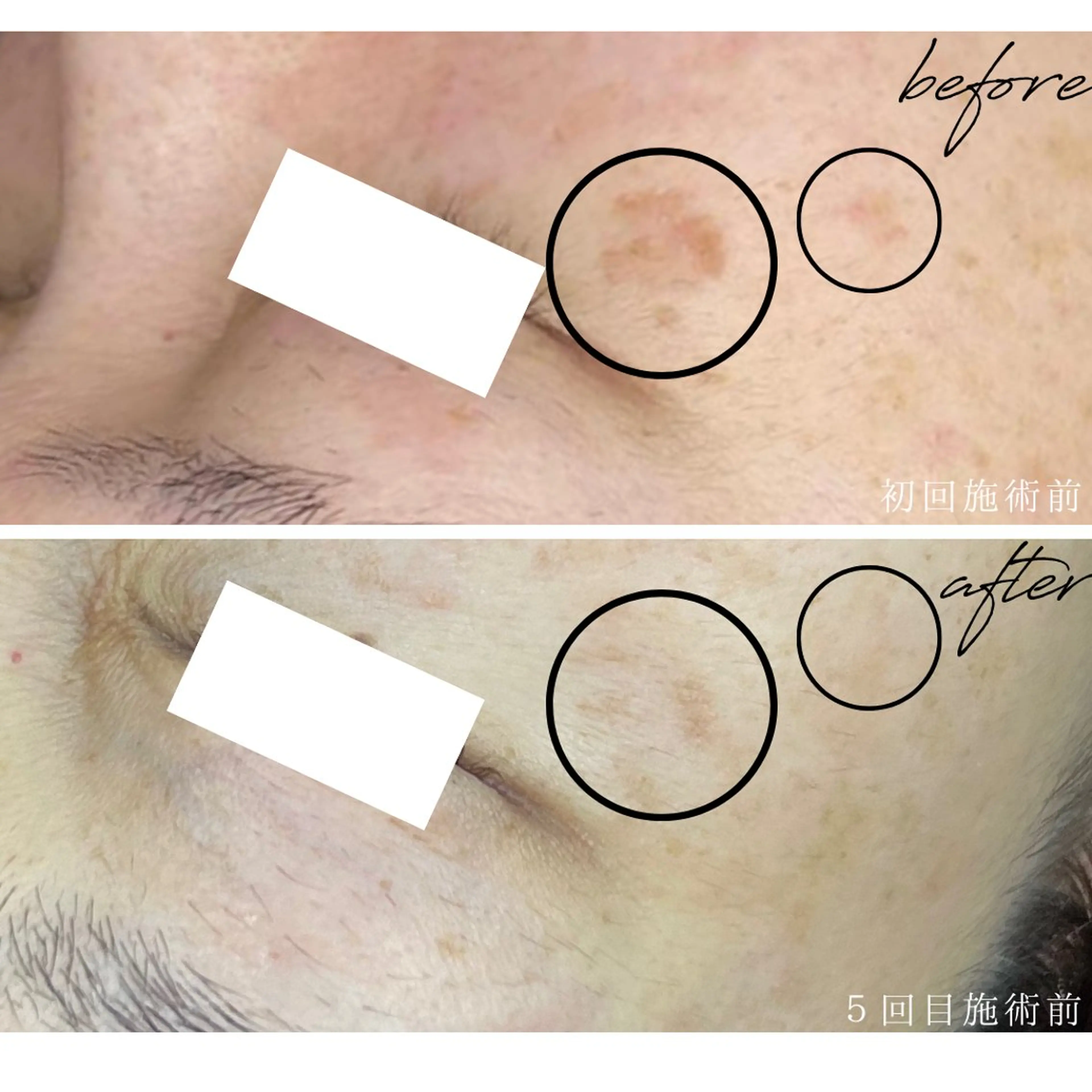 エステ 最新シミケアLily de pearlのエステ・リラクイメージ