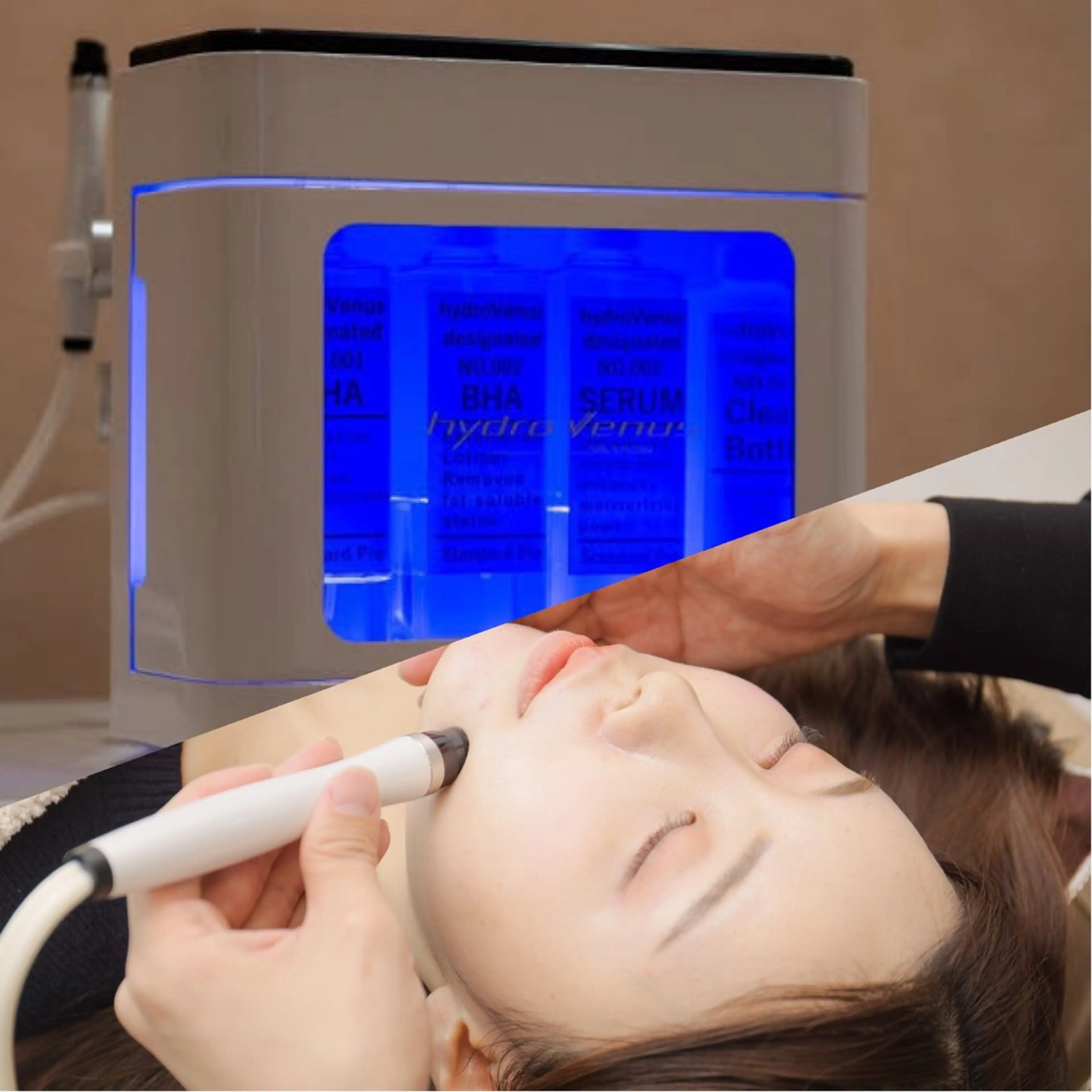 最速小顔・肌質管理 ❣️エスポワールのエステ・リラクイメージ