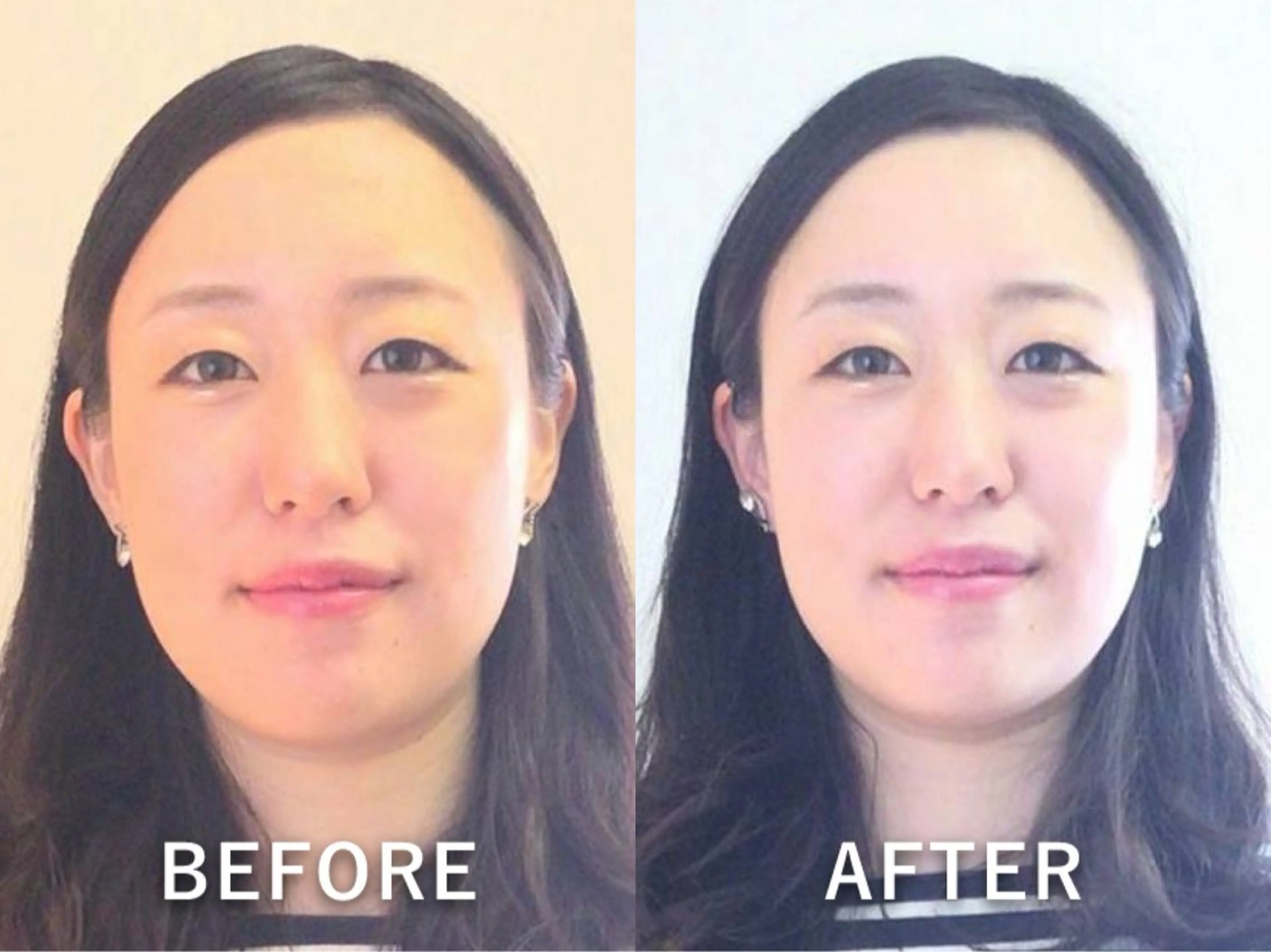 エステ リラク 坂井 ゆいのエステ・リラクイメージ