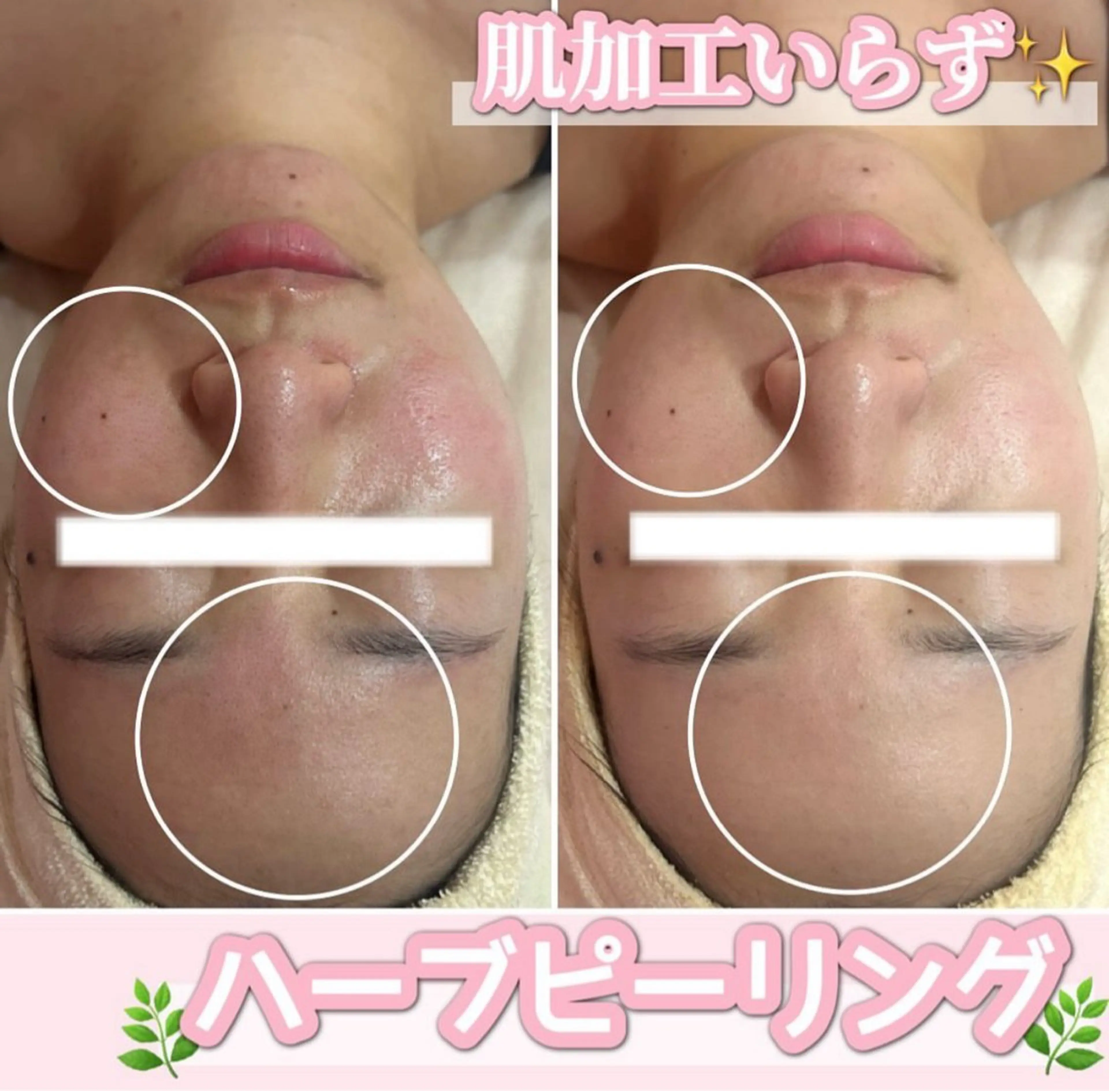 エステ SALON所属・SALON韓国肌管理 東別院のエステ・リラクイメージ