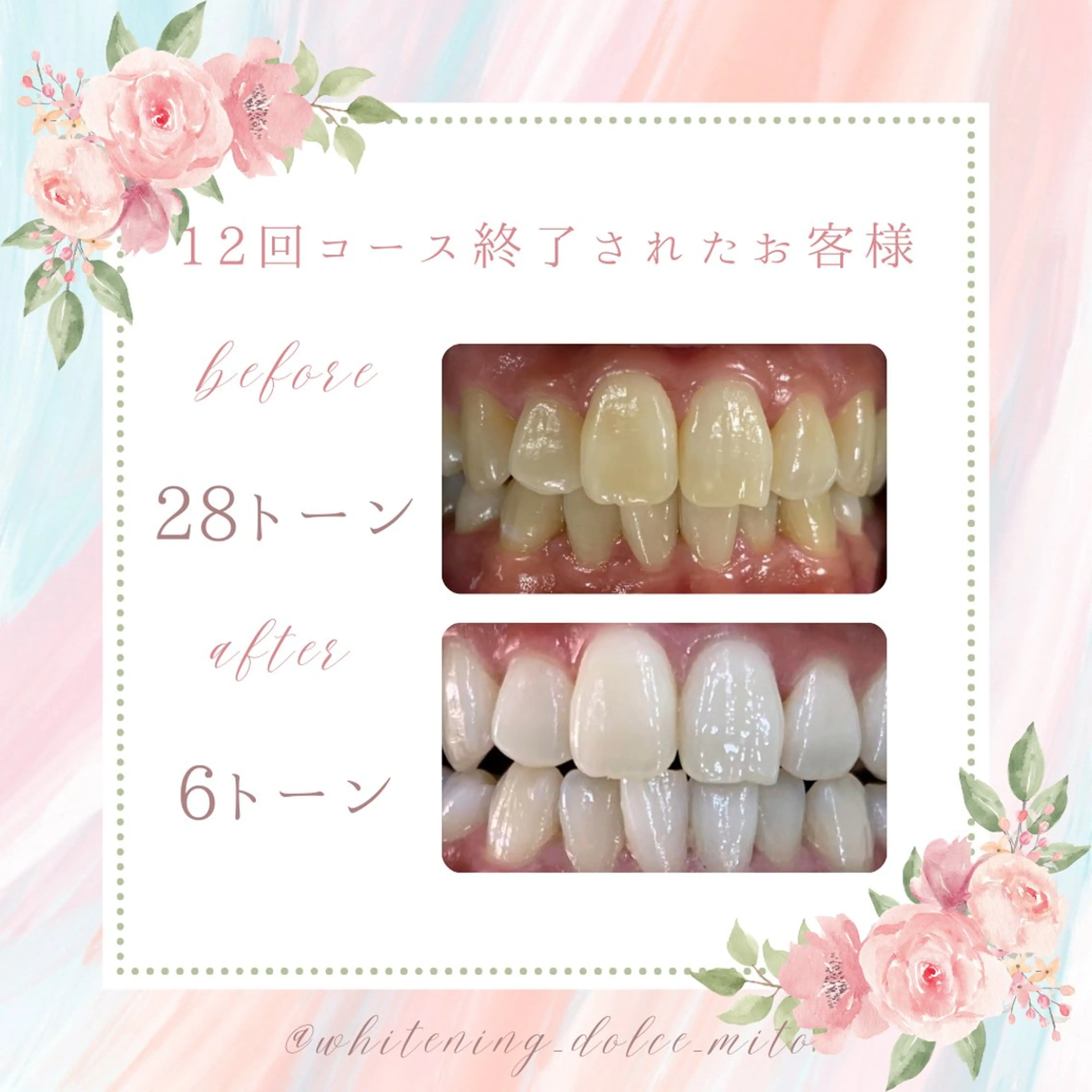 セルフホワイトニング Dolce水戸店のその他イメージ