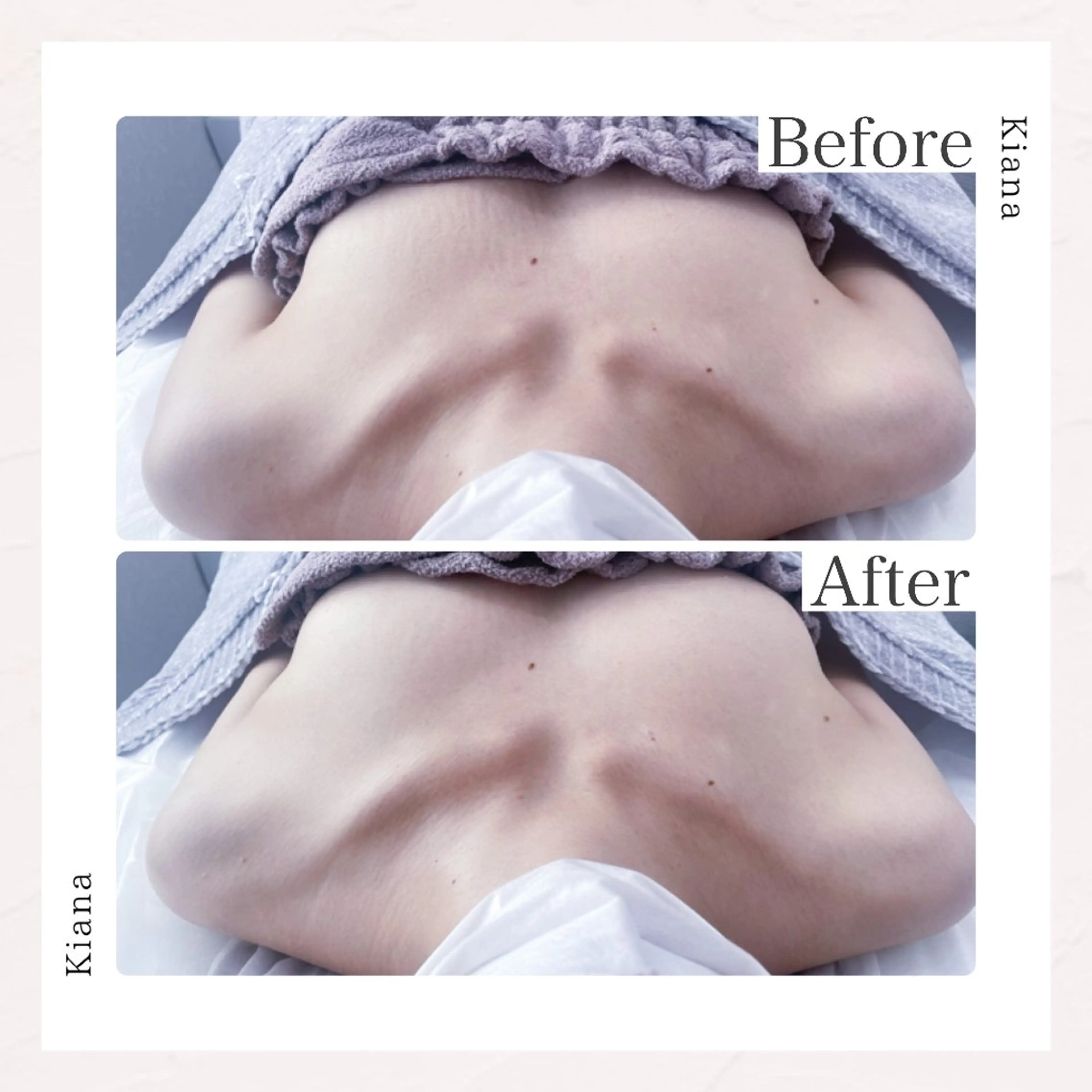 【バスト専門店 】 Kiana のエステ・リラクイメージ