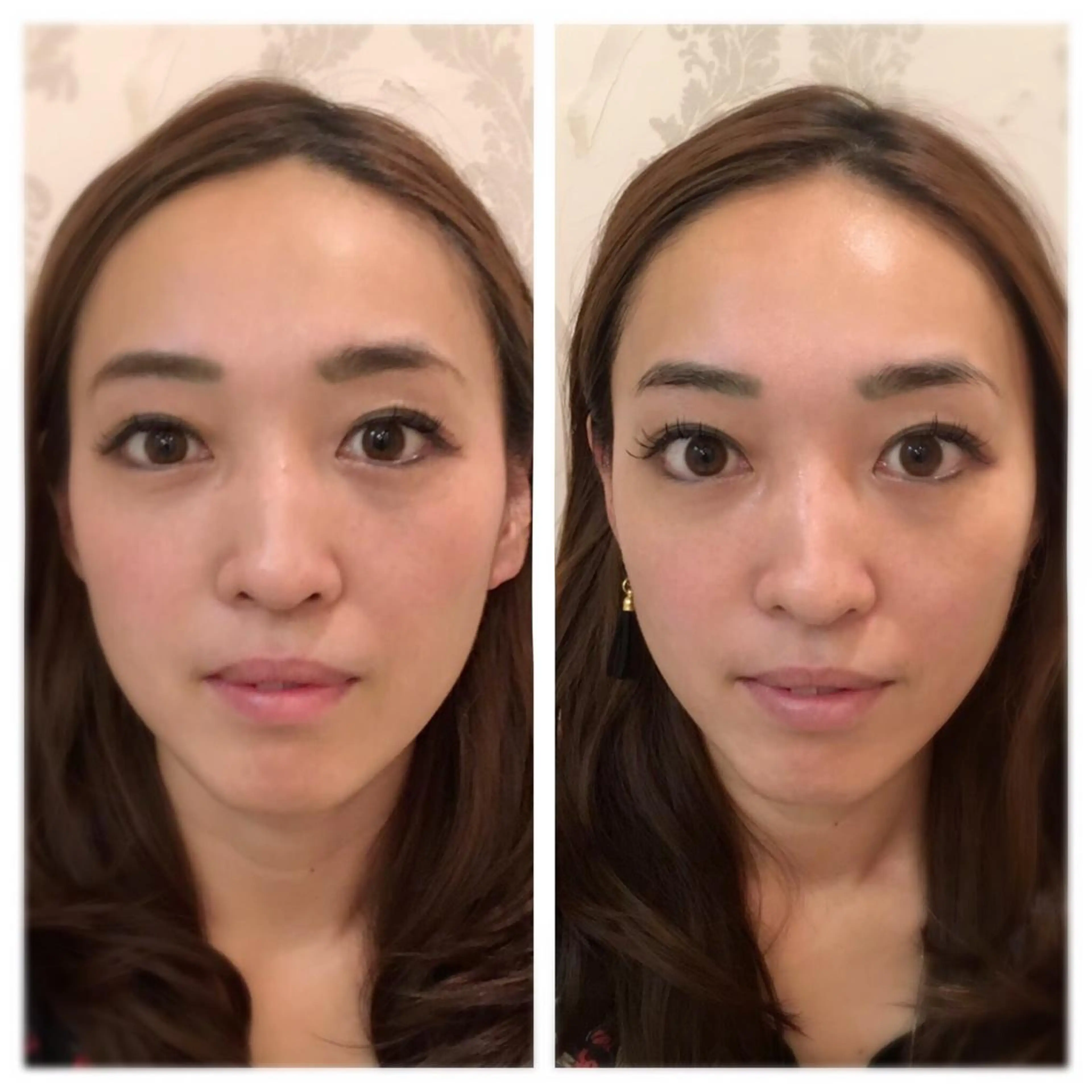 美容鍼サロン    Fleurir所属・伊藤 かなえのエステ・リラクイメージ