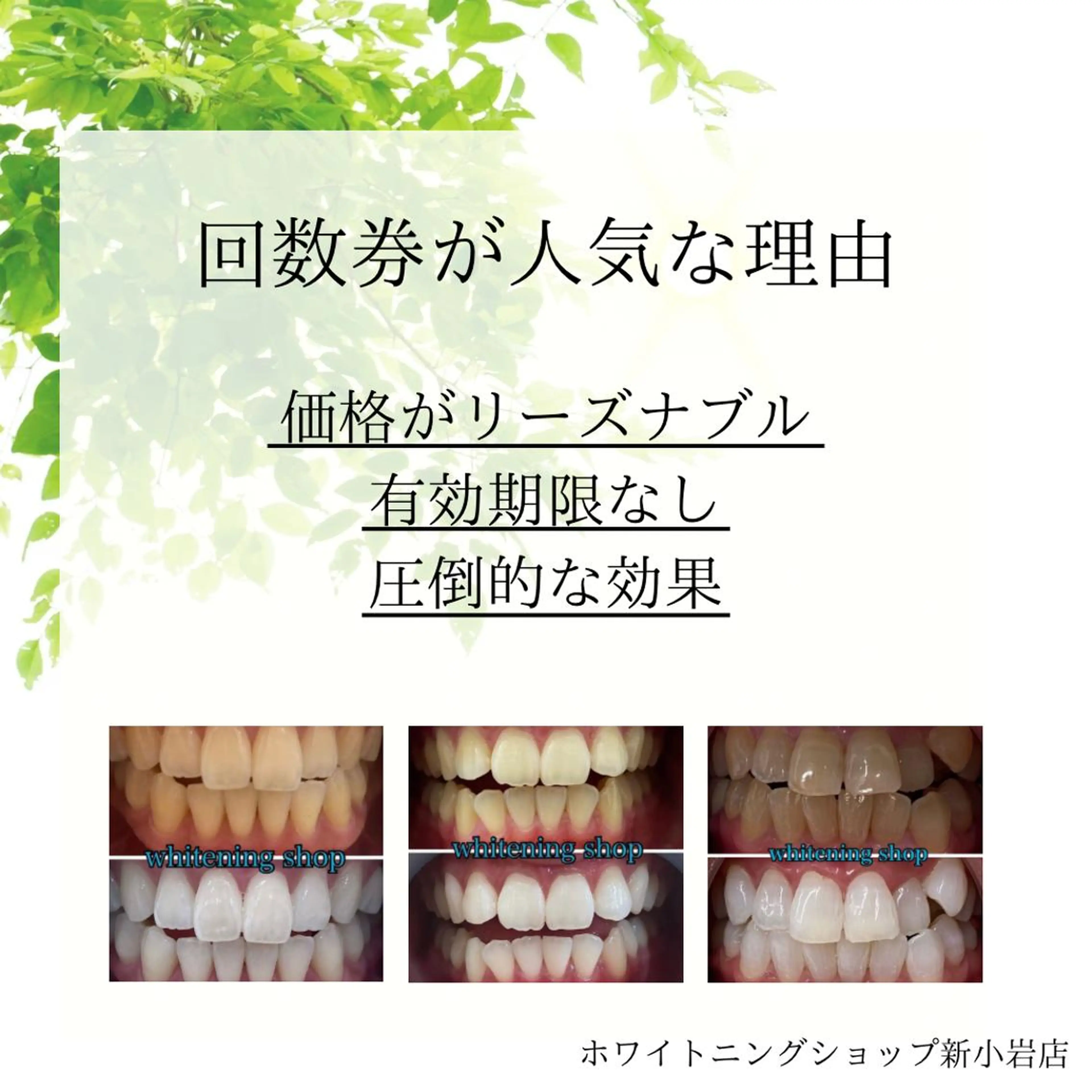 メンズ その他 ホワイトニング ショップ新小岩店のその他イメージ