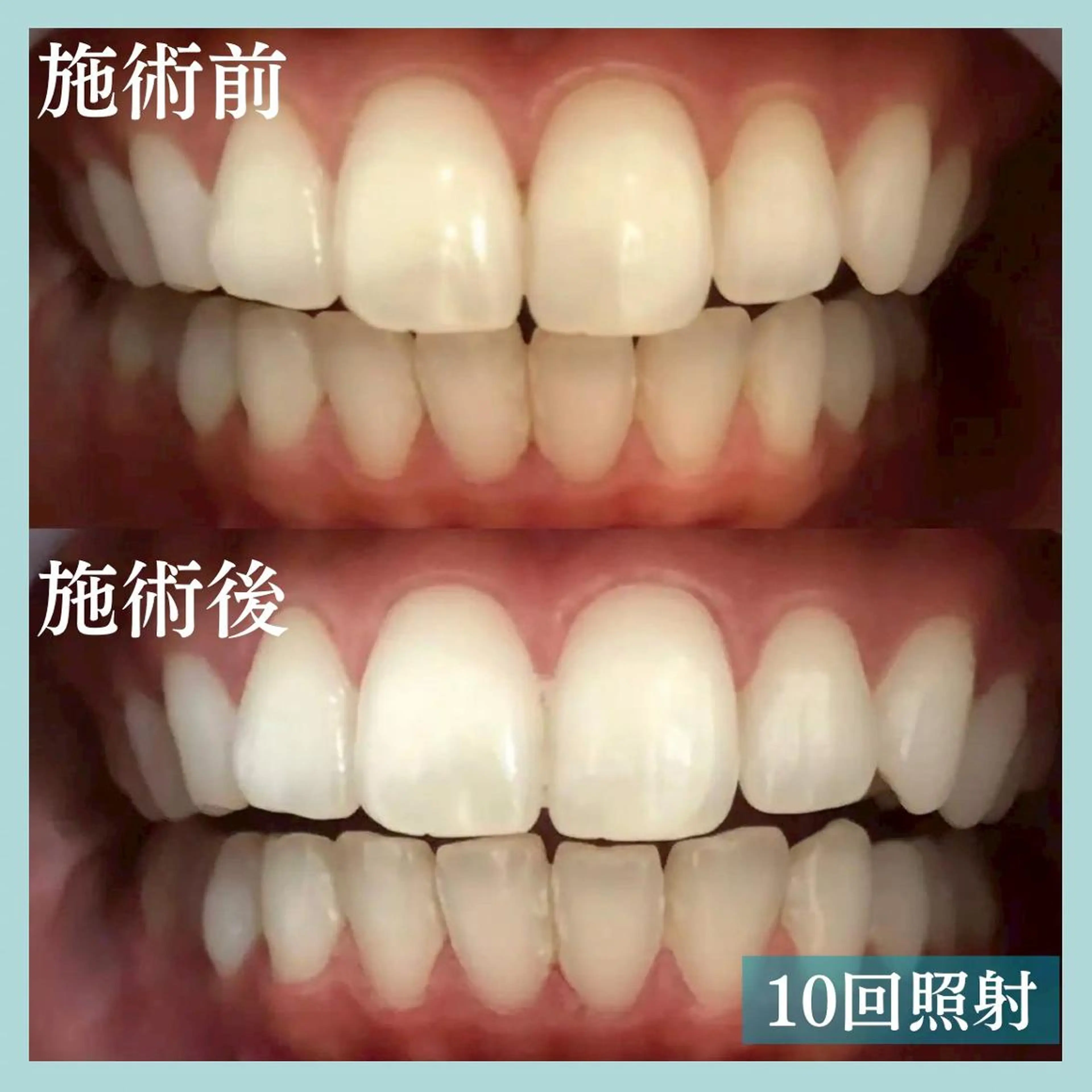 LBS 吉祥寺店🐣店長加納のエステ・リラクイメージ