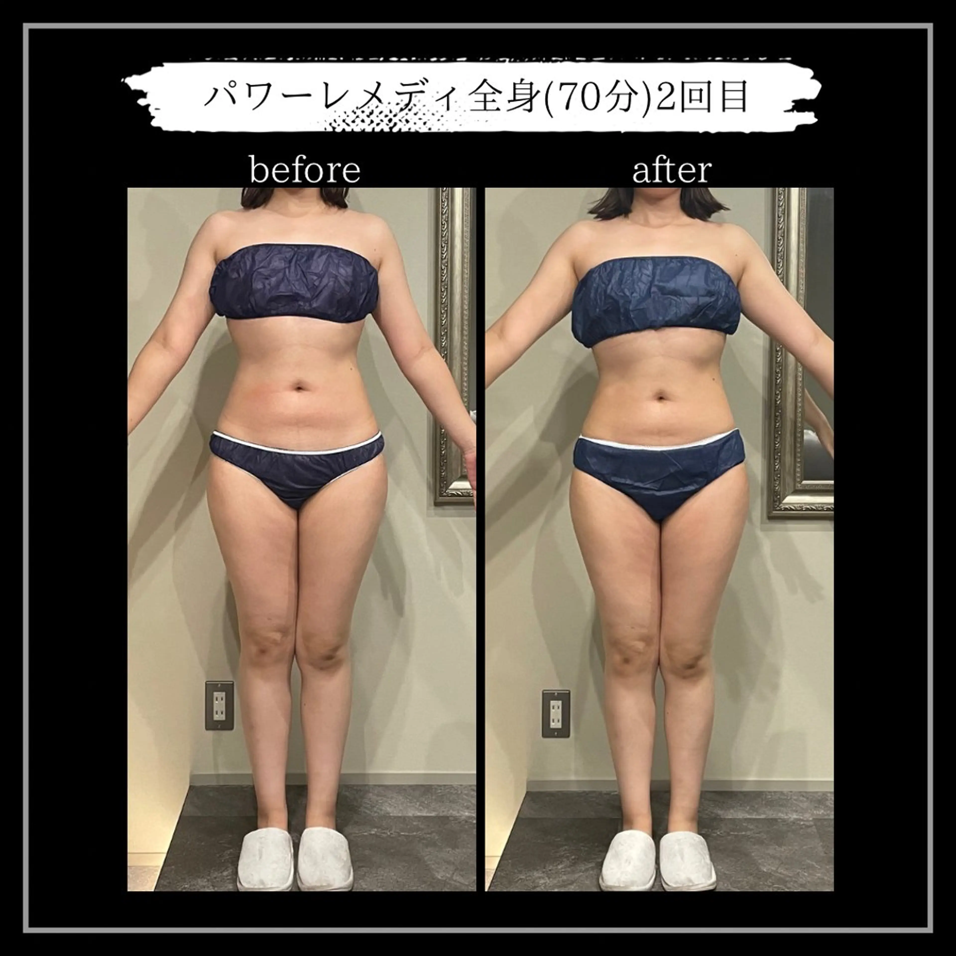 オフ:オン所属・オフ:オン 全身筋膜マッサージのエステ・リラクイメージ