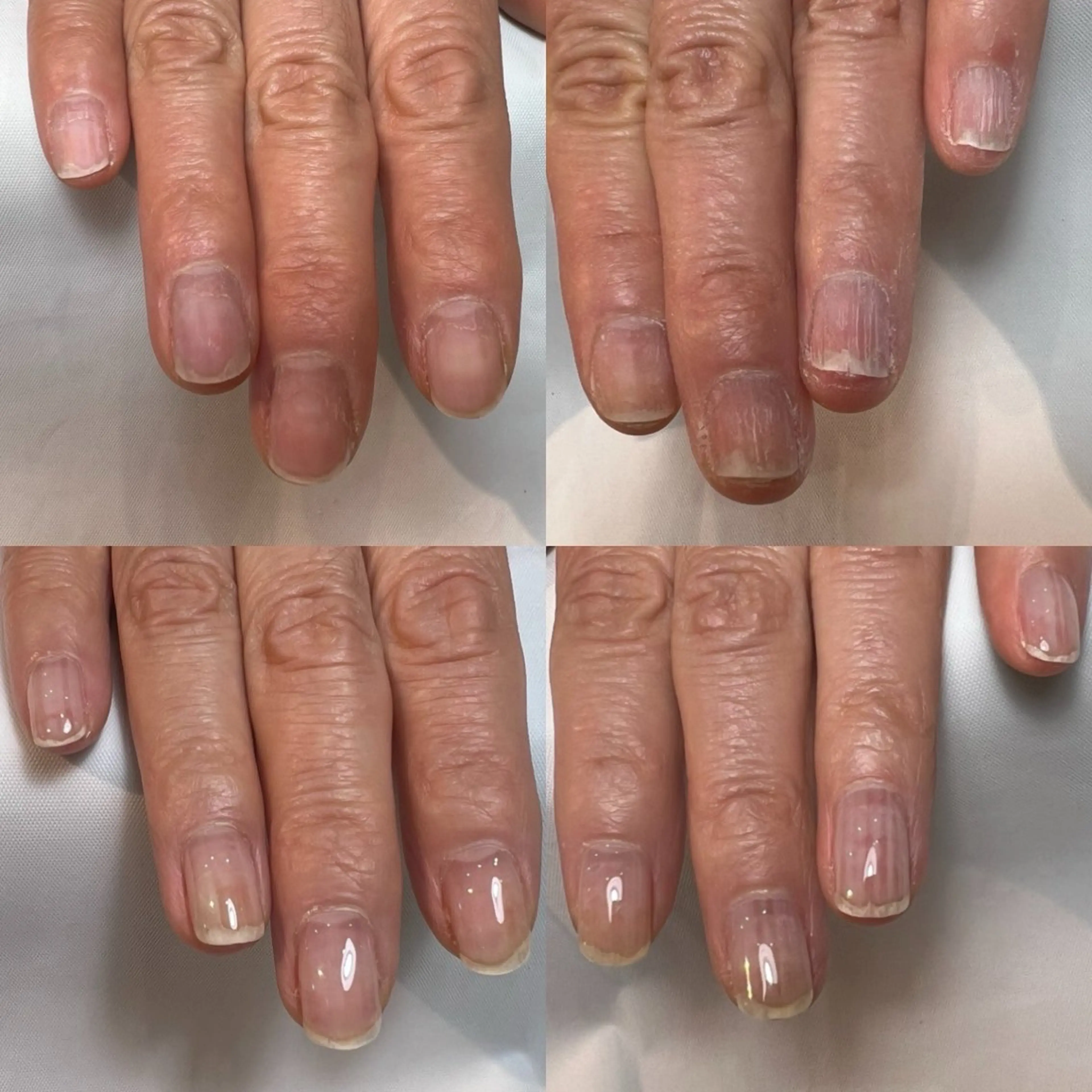 【初回カウンセリング無料】剥離爪ハンドケアの写真