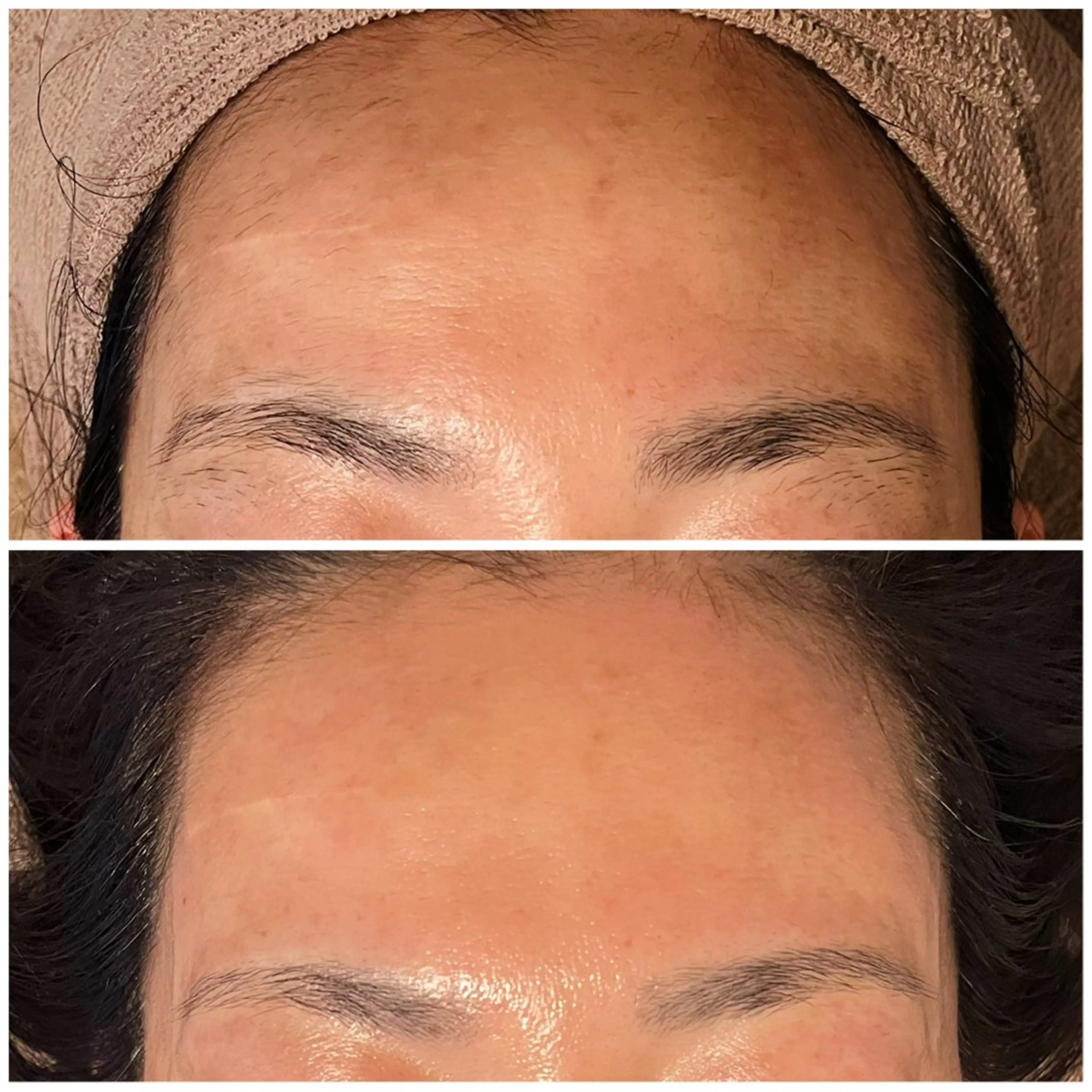 アイブロウ Ｂ&H所属・頭痛•肩こり専門/ 眉サロンB&H心斎橋のエステ・リラクイメージ