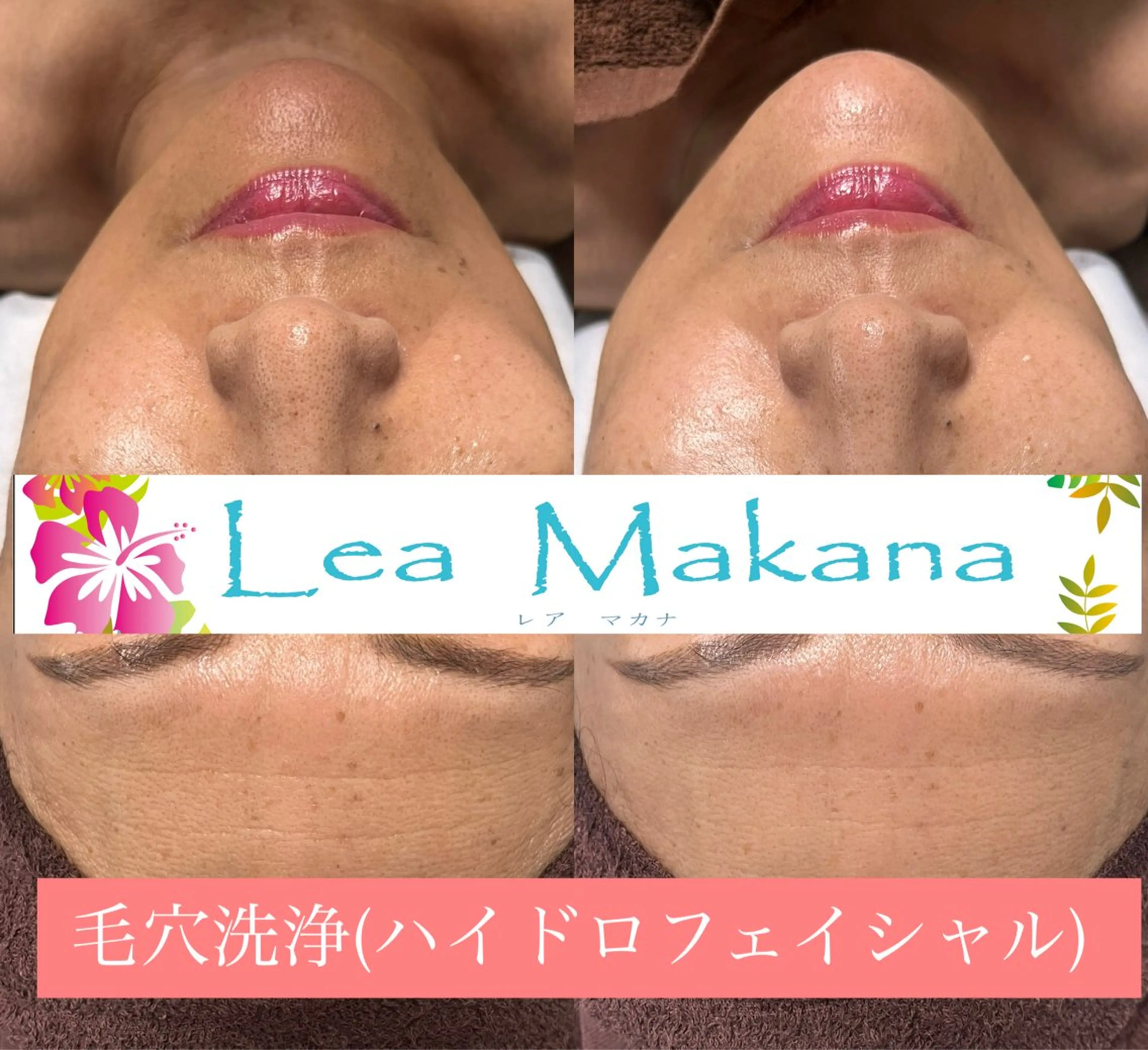 エステ Lea Makana-レアマカナ所属・毛穴洗浄🍀脱毛🍀 光フェイシャル🍀のエステ・リラクイメージ