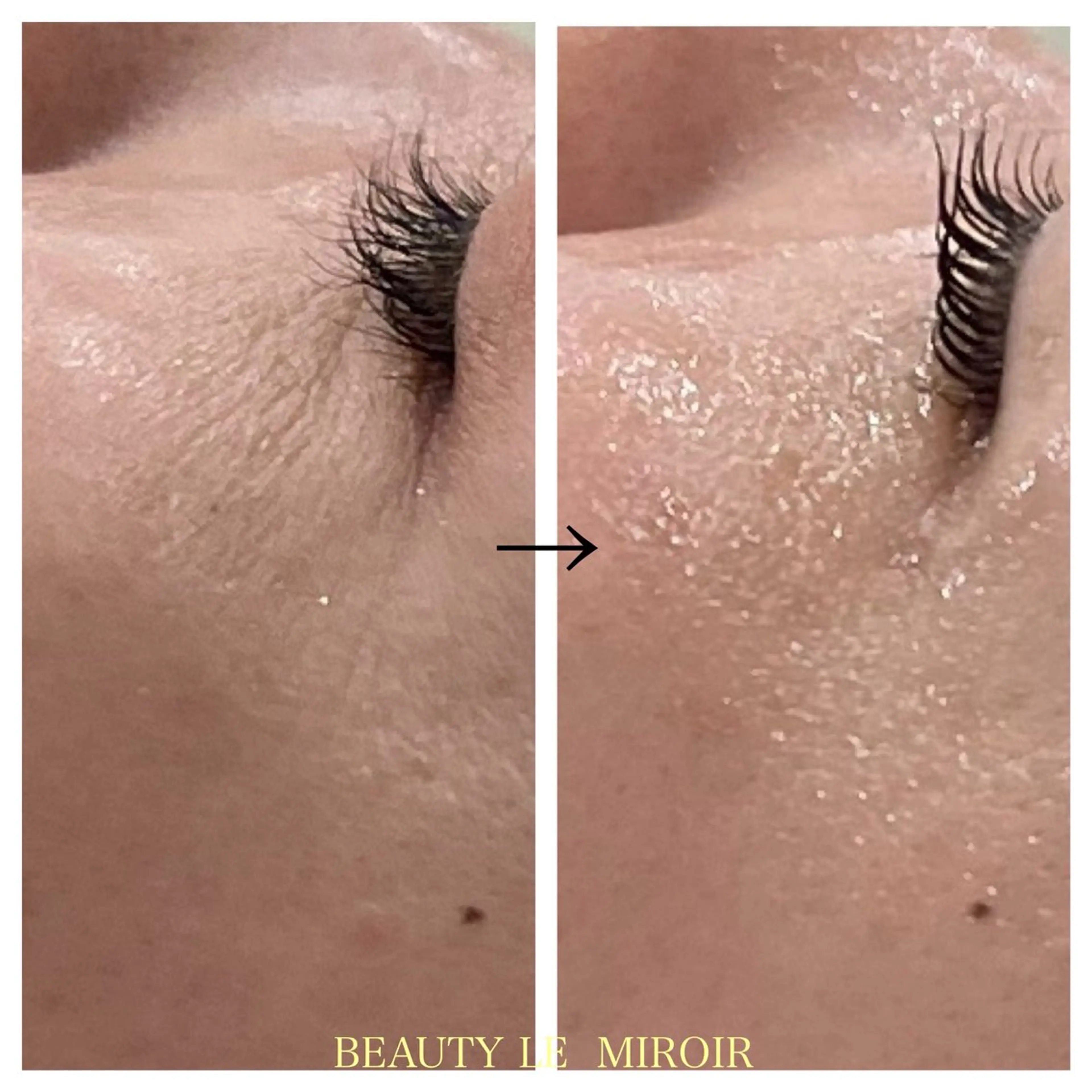 エステ ビューティー ミロワールのエステ・リラクイメージ