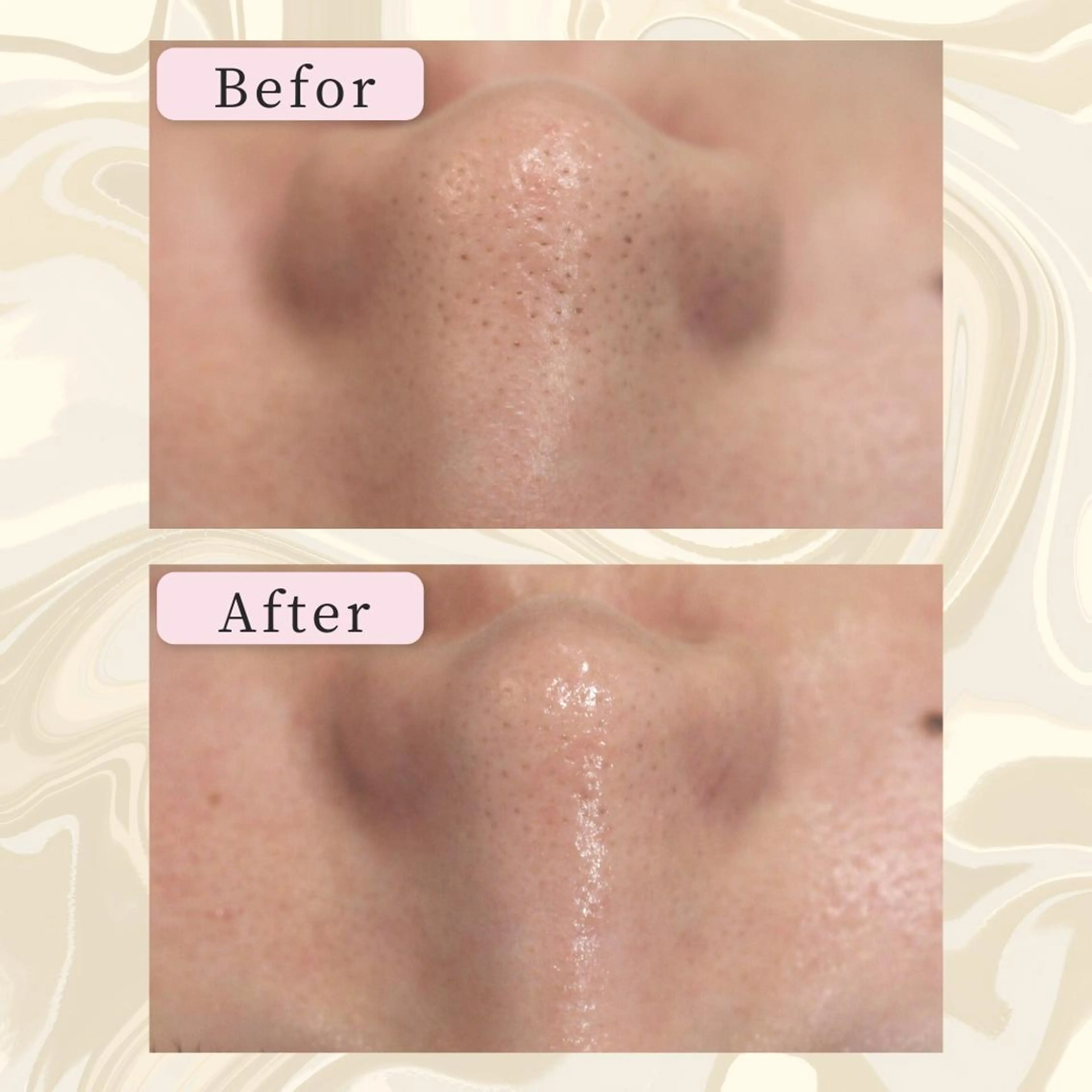 ANRIRE (アンリール)のエステ・リラクイメージ