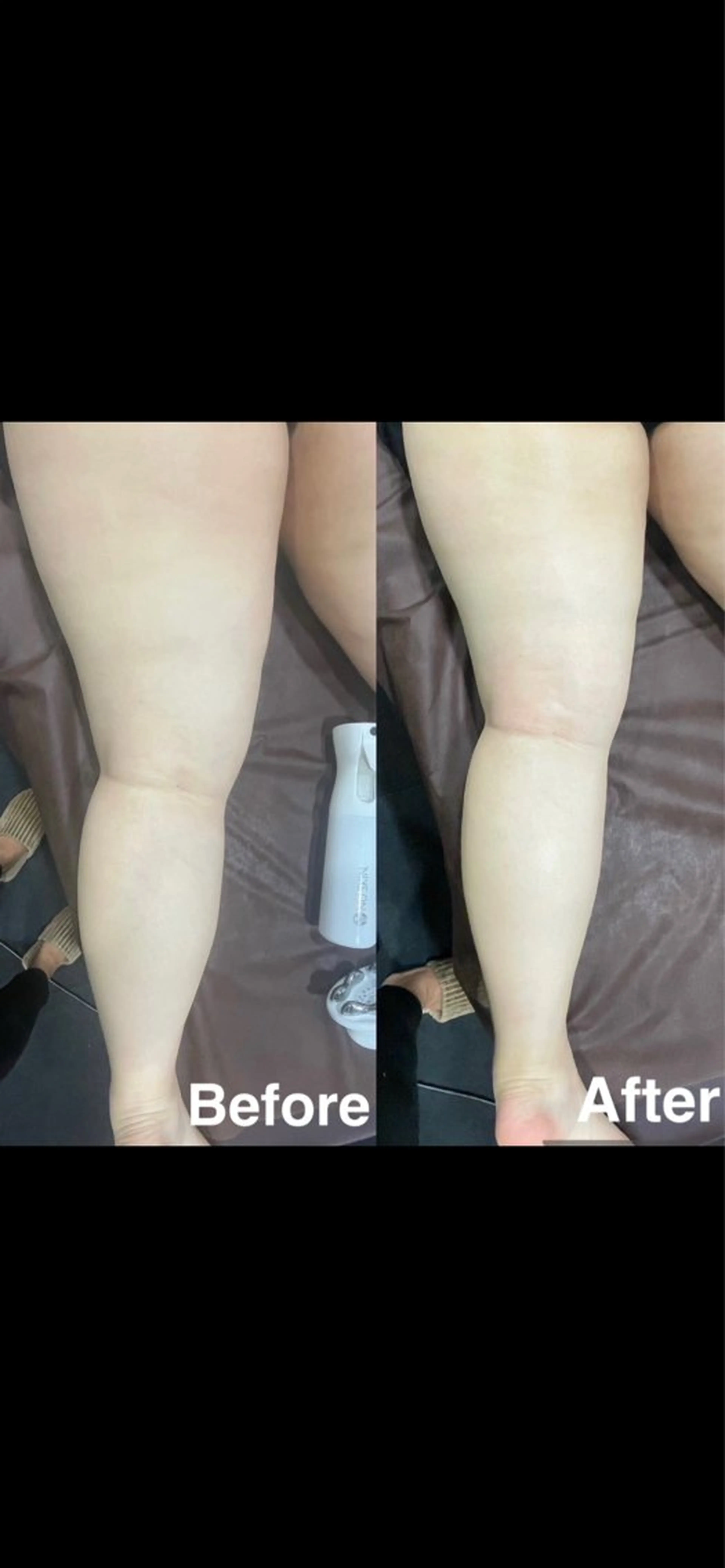 TotalBeautySalon Erea所属・藤田 愛美のエステ・リラクイメージ