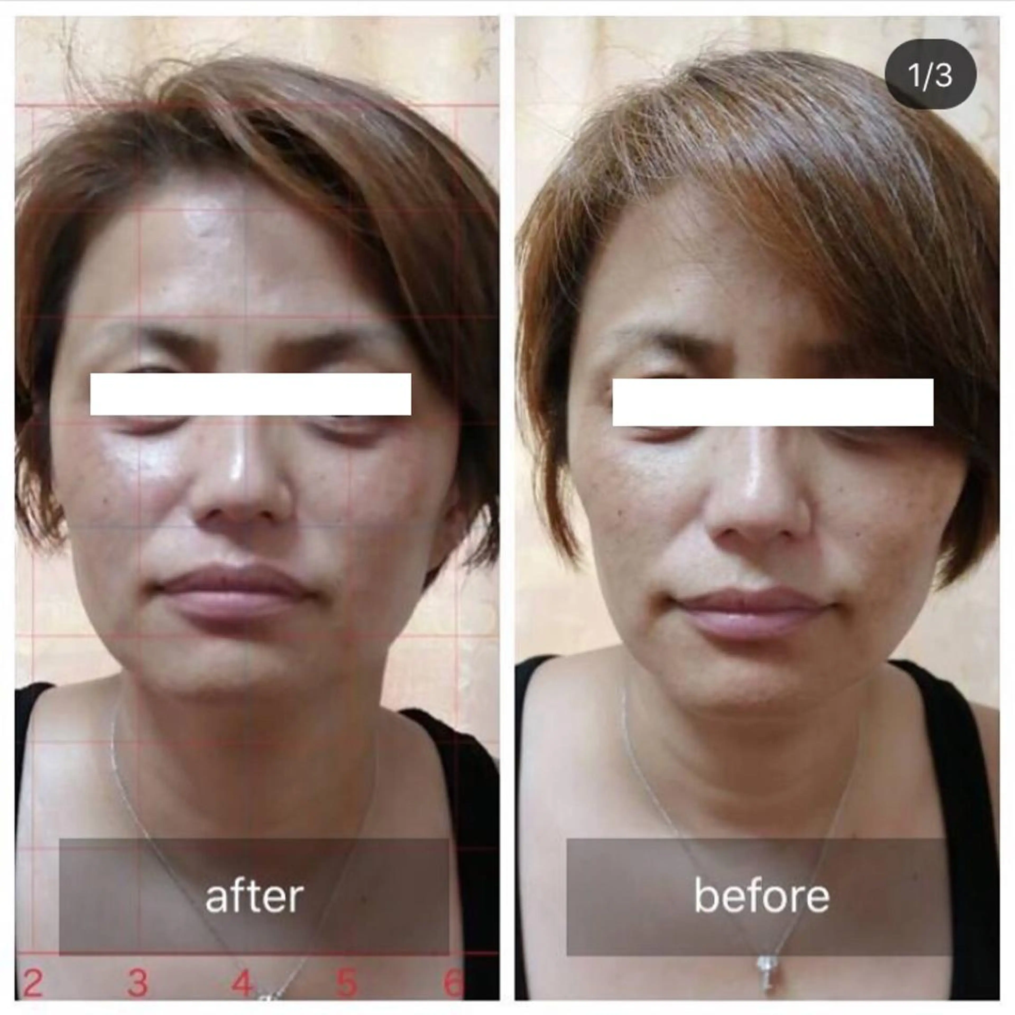 未病ケアサロン　EMINY所属・未病ケアサロン EMINY☺︎勝俣のエステ・リラクイメージ