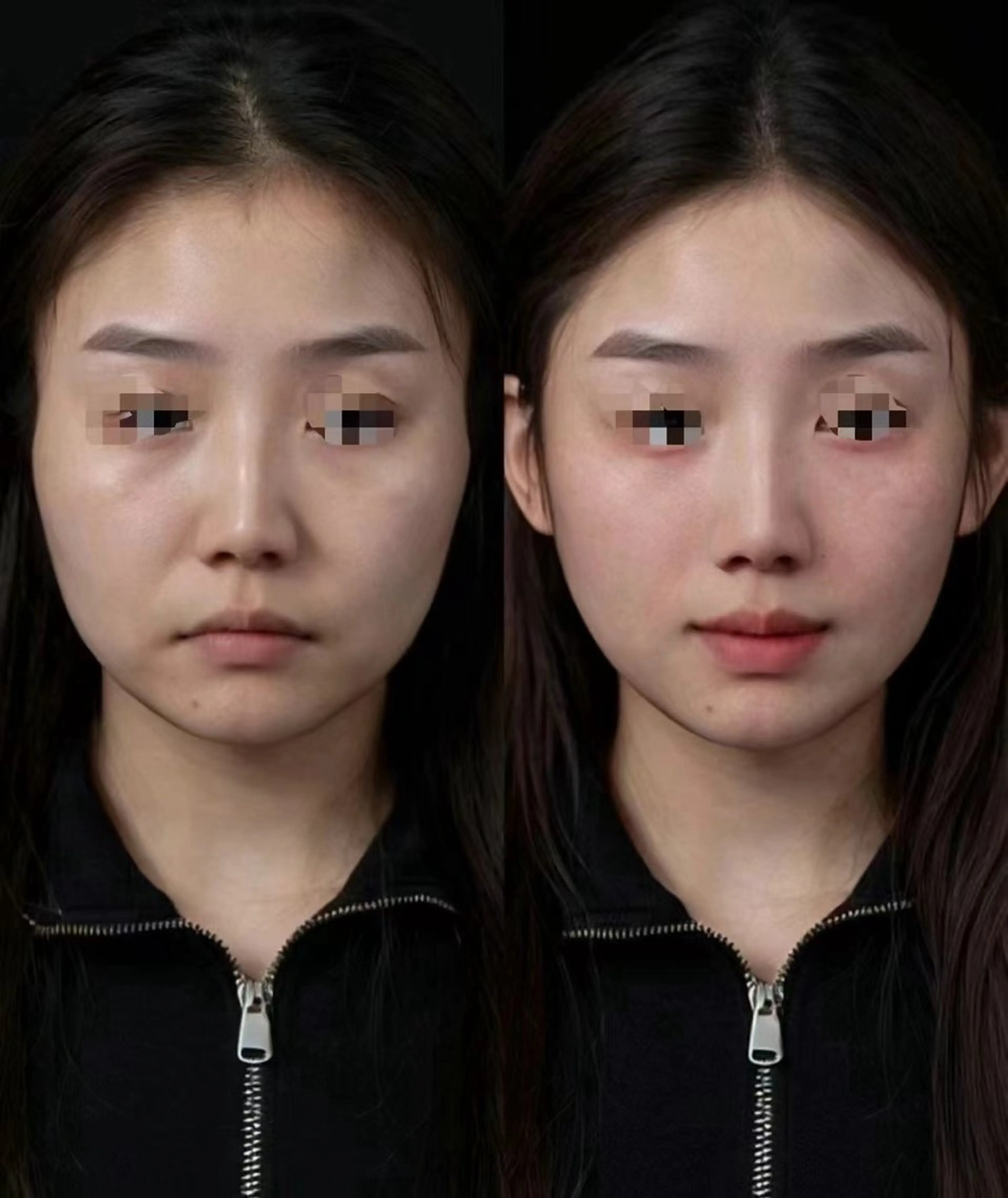 ネイル エステ aliaハイフ&水光ジェットサロン所属・aliaハーブ水光店 エステティシャン募集のエステ・リラクイメージ