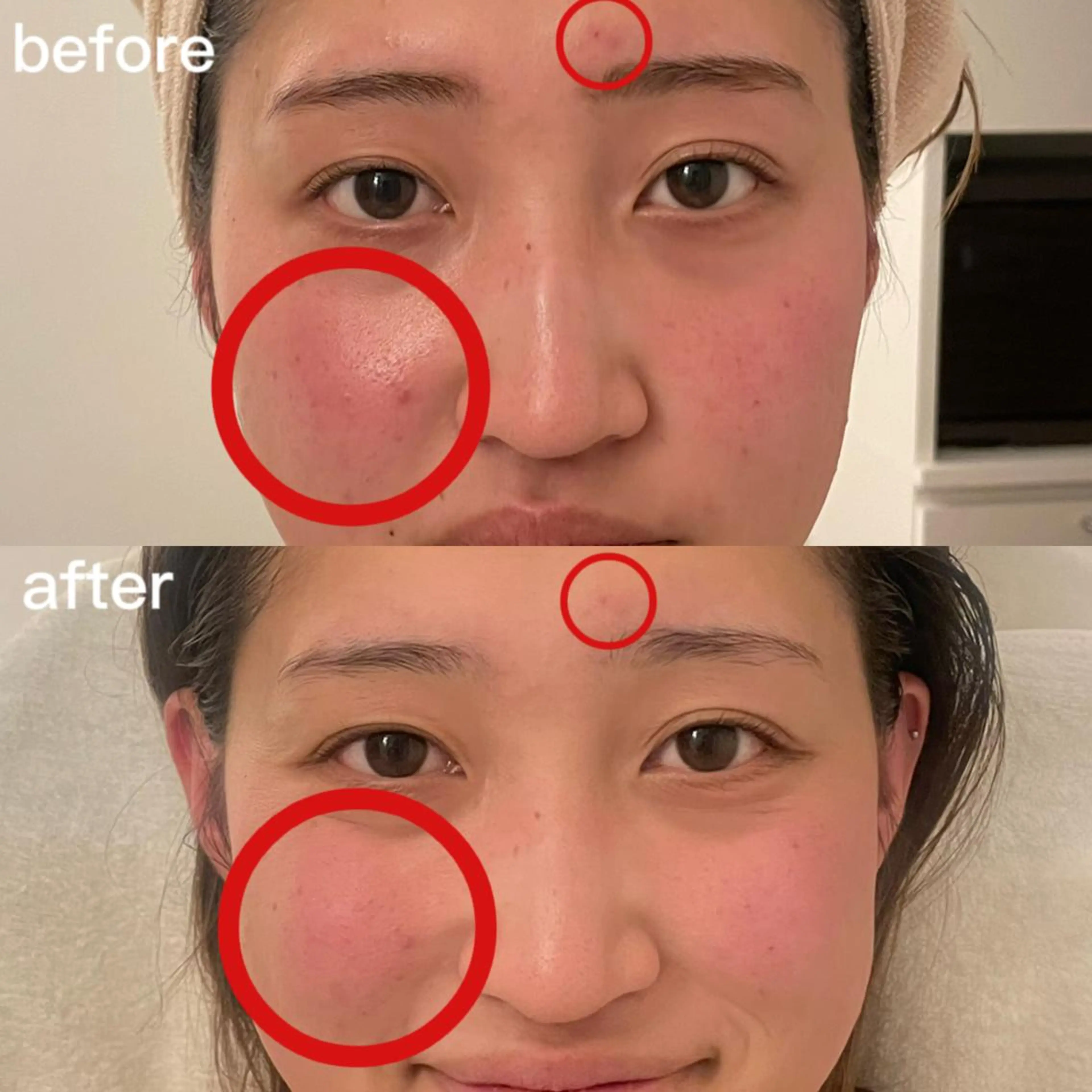 アピタ千代田橋店 POLA THE BEAUTY所属・エステ ツヤ肌 マッサージ POLAのその他イメージ