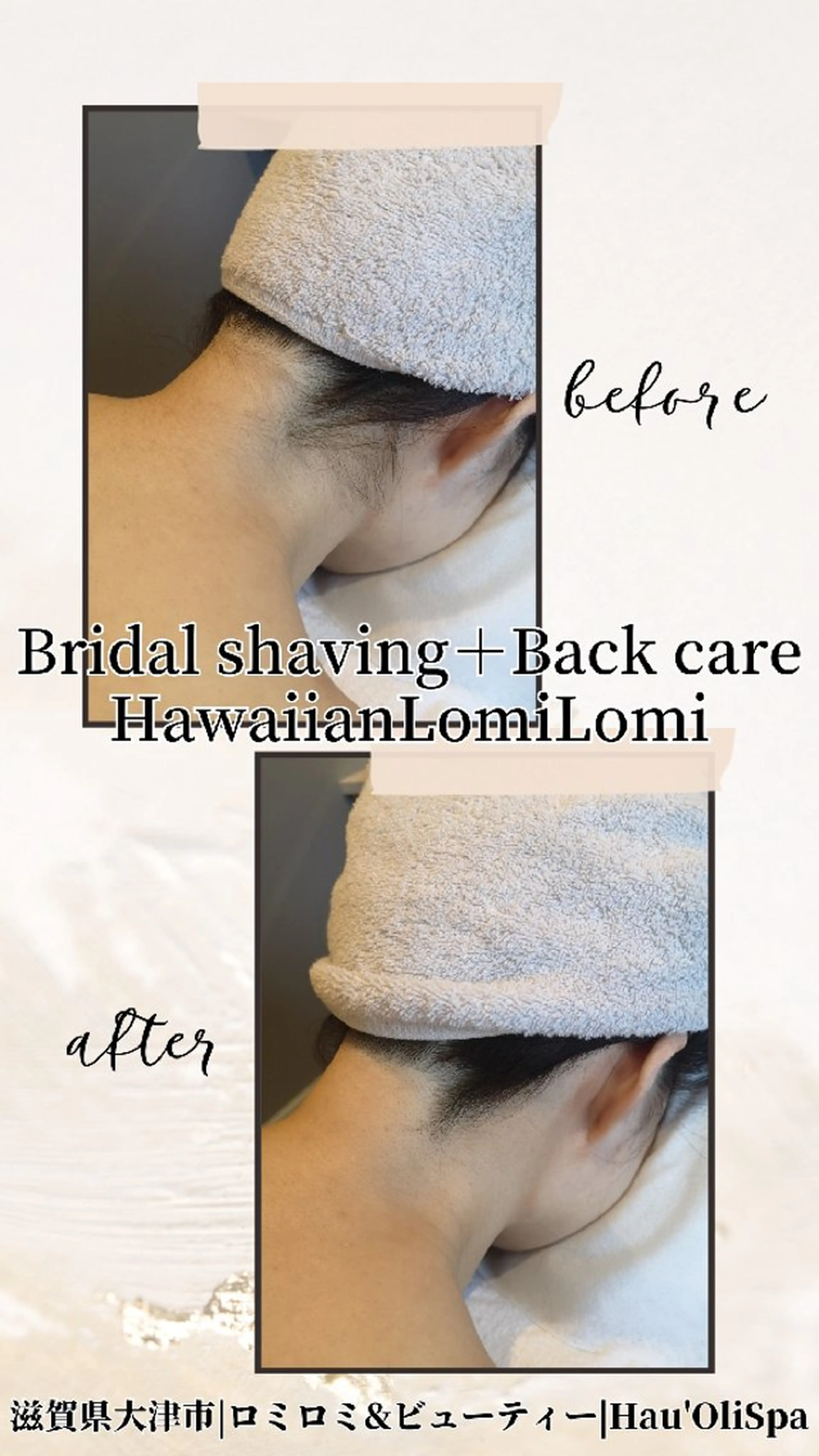 【1day☆本番直前ブライダルエステ】シェービング＋背中ケア＋毛穴美人フェイシャル140分の写真