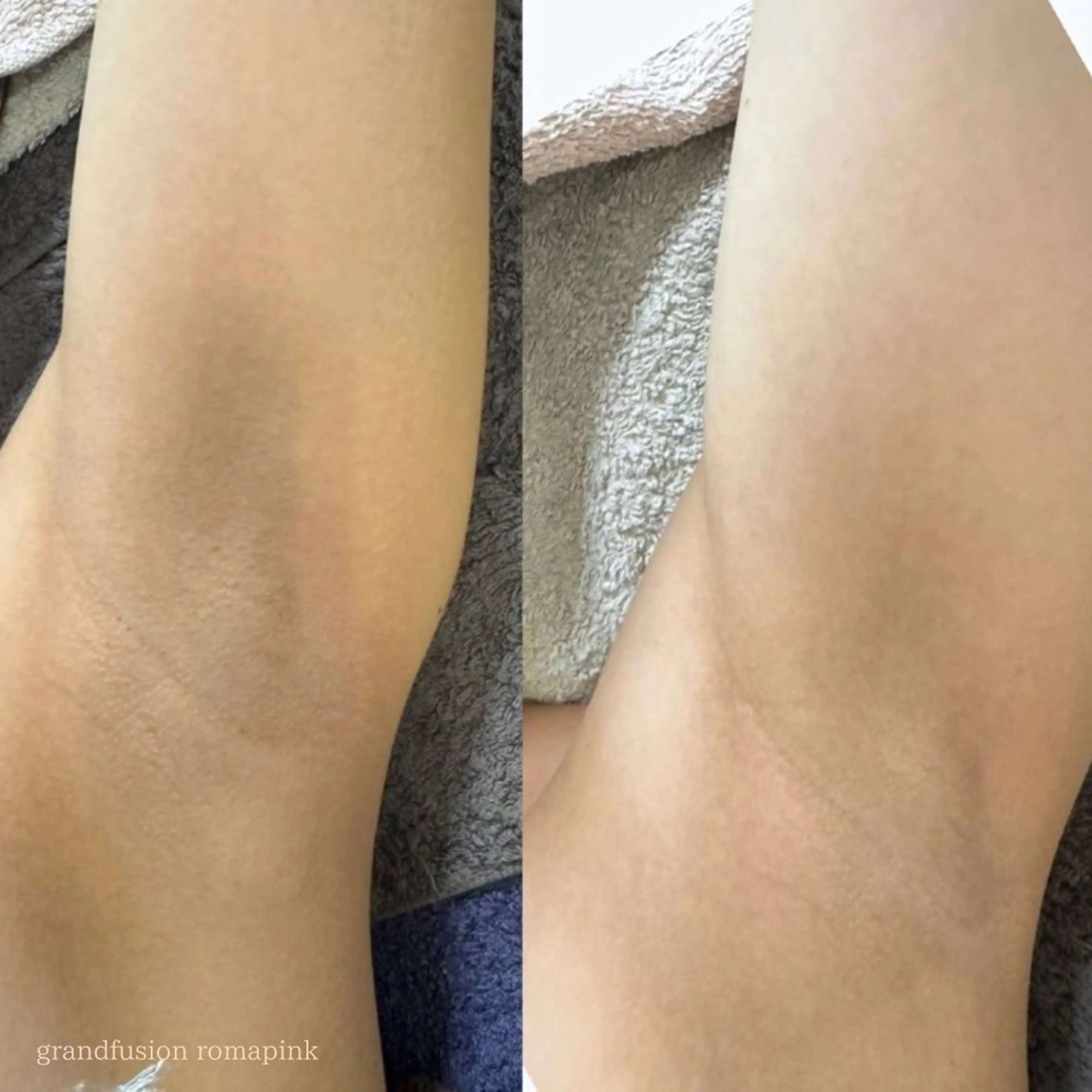 本気で痩せたい方へ 痩身専門サロンのエステ・リラクイメージ