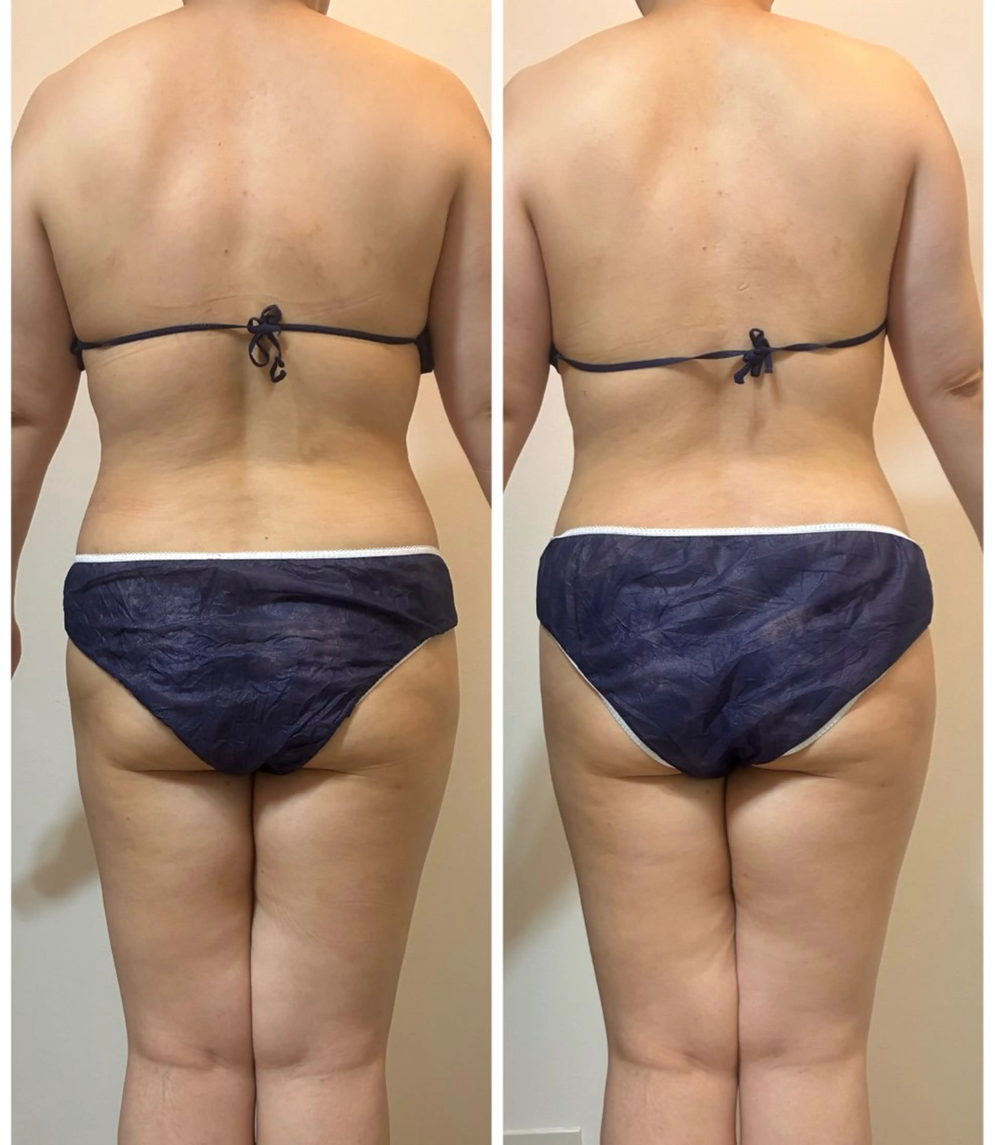 デトックス×ボディメンテナンスサロンShikhara（シカラ）所属・オールハンド筋膜痩身 整体/小顔　中山朝美のエステ・リラクイメージ