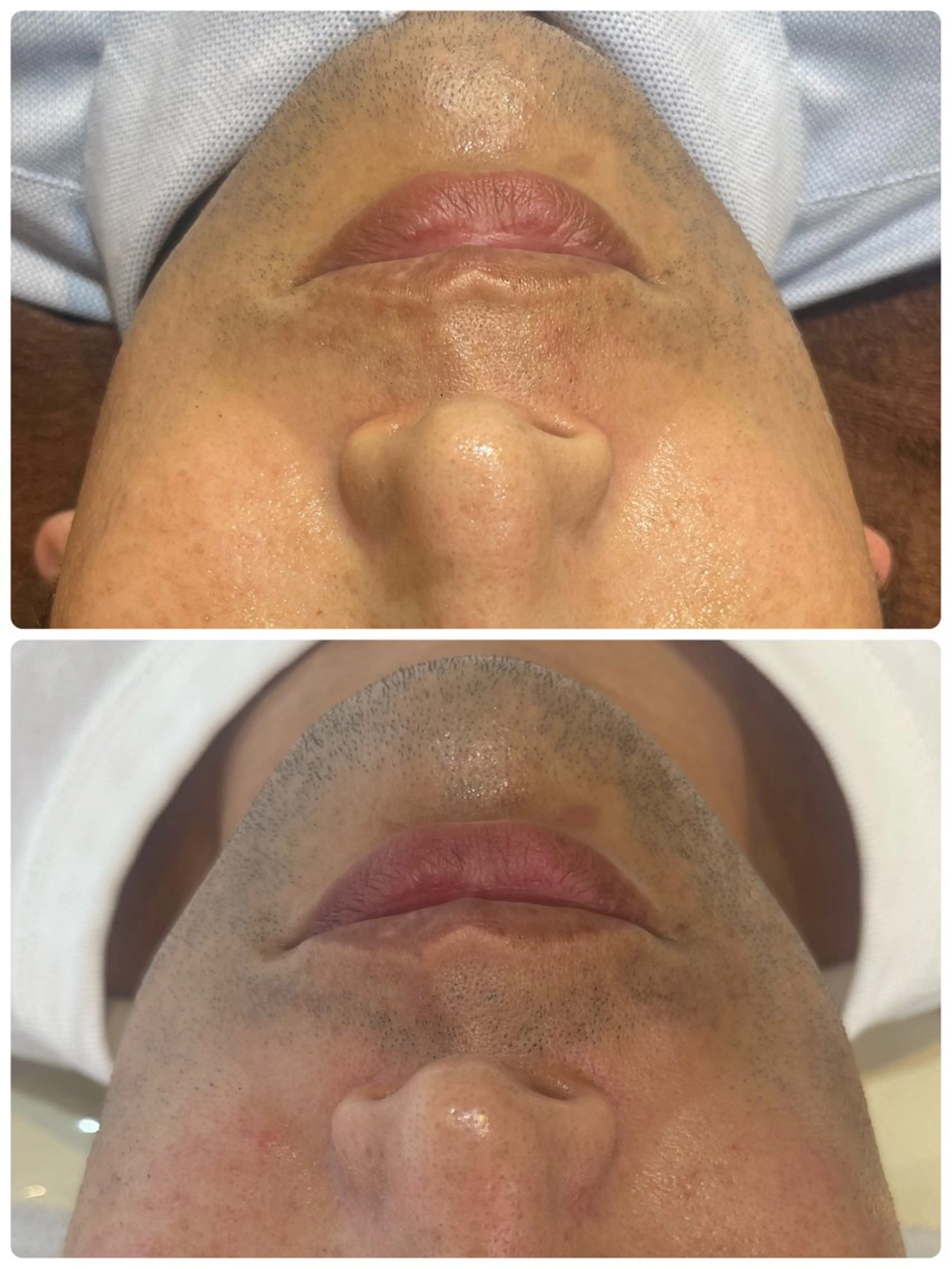 バストアップ・脱毛 🌺Ko Olinaのエステ・リラクイメージ