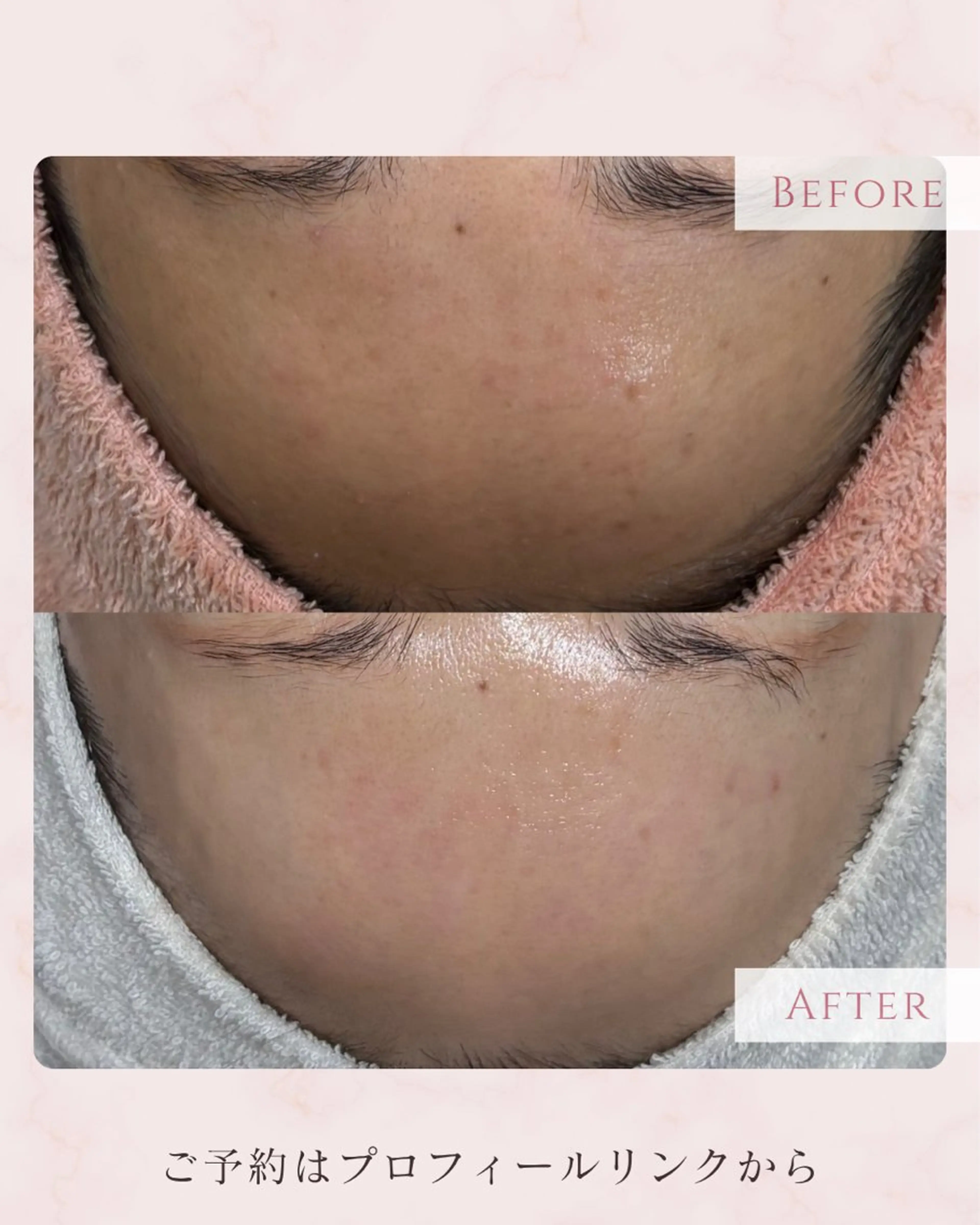 エステ 肌育フェイシャル🌿 noel🌿SAKIのエステ・リラクイメージ