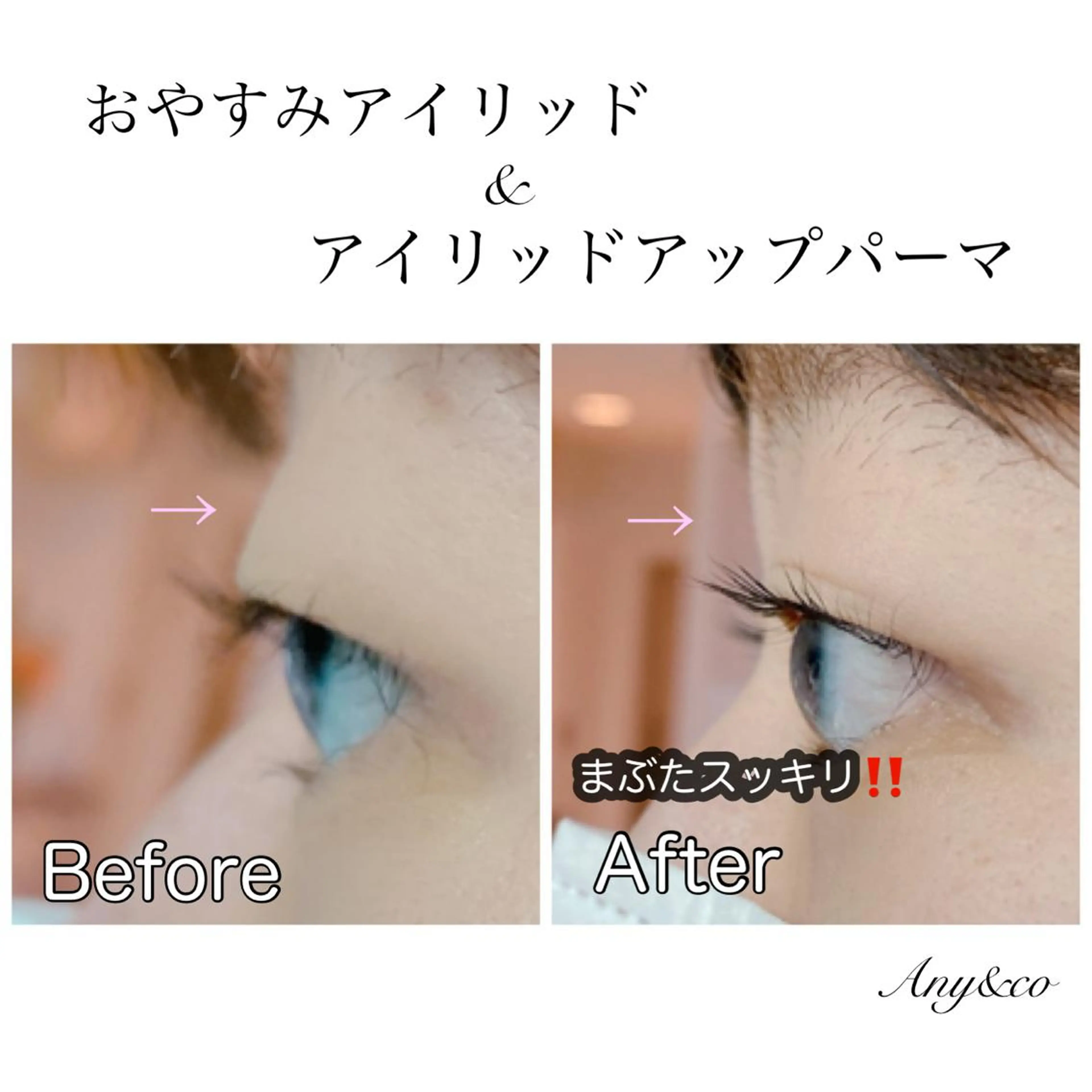 マツエク・マツパ アイリッドアップパーマ Any&co 【エニコ】のマツエク・マツパデザイン