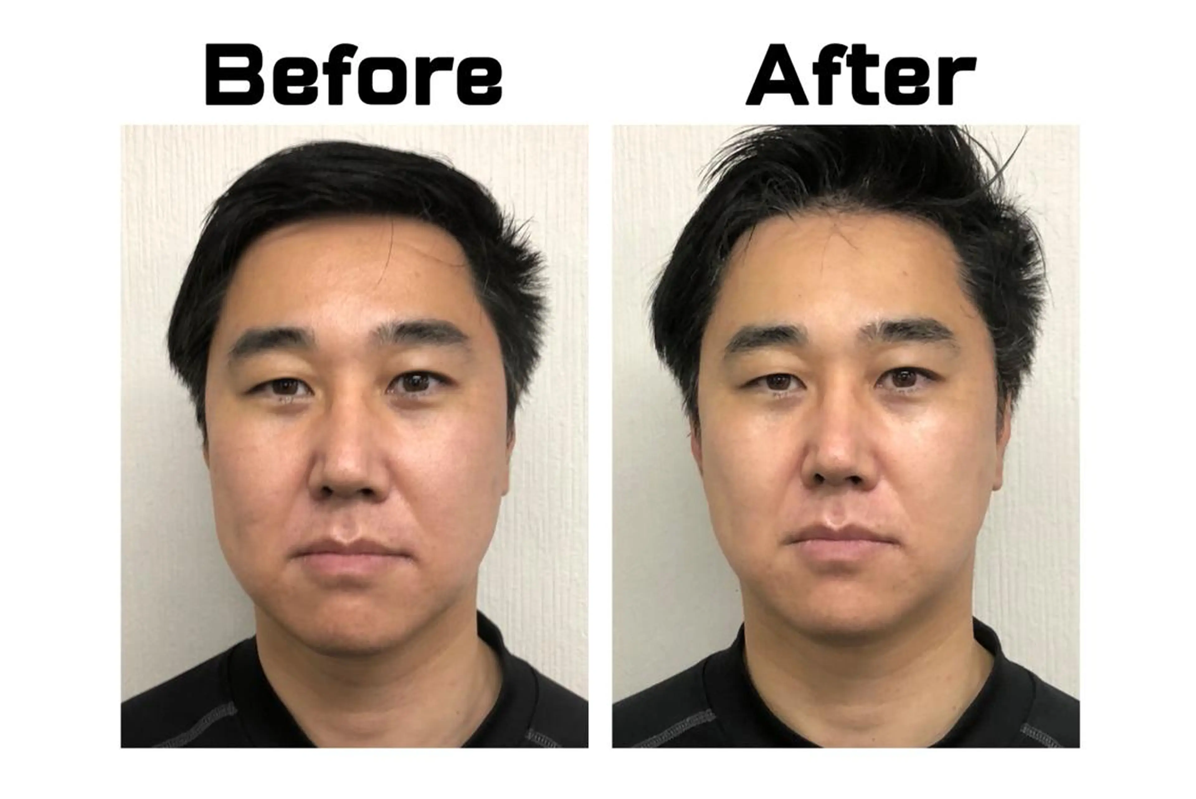 その他 水島 秀輝（美容鍼灸師）のその他イメージ