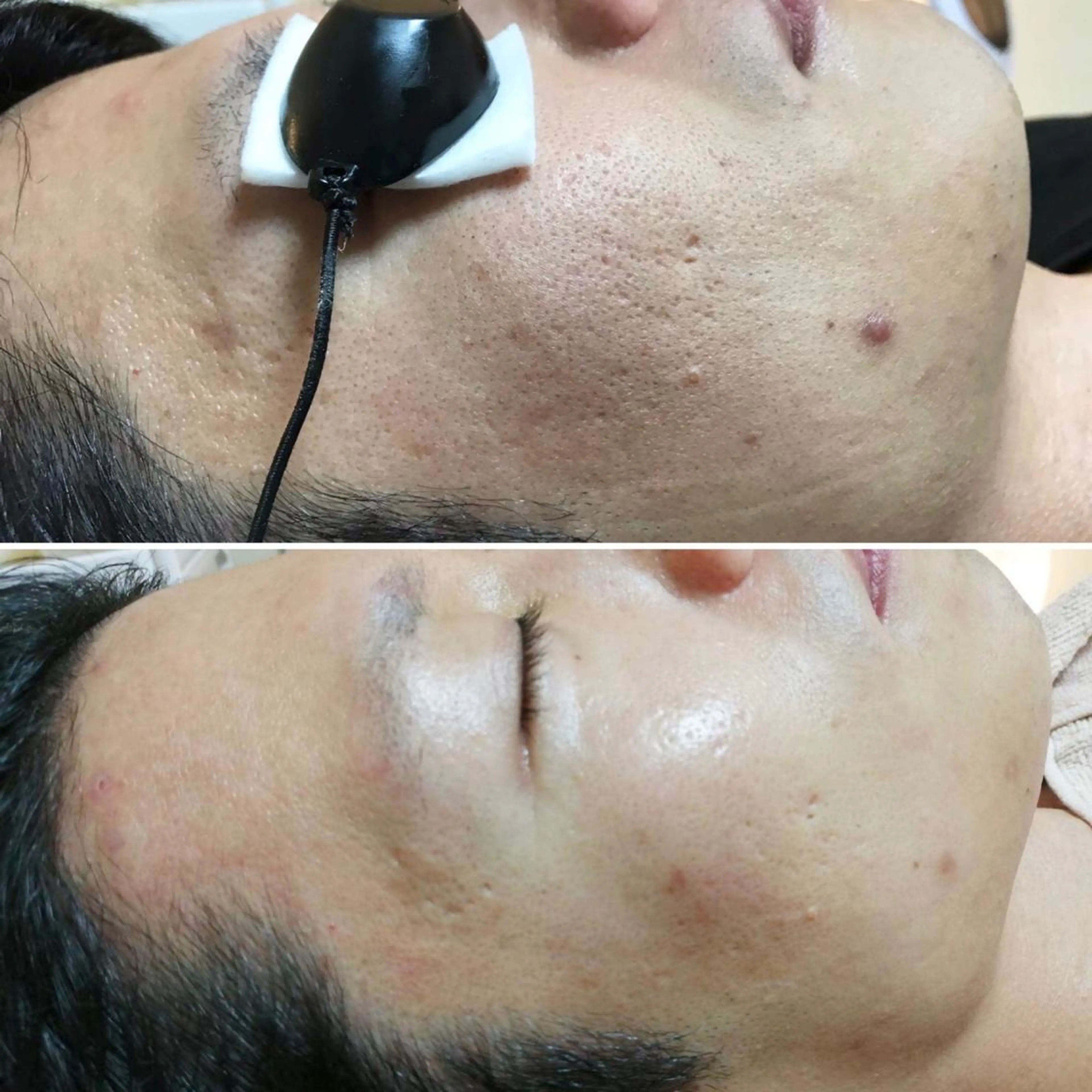 男女同額完全個室脱毛 LEPIA内田のエステ・リラクイメージ