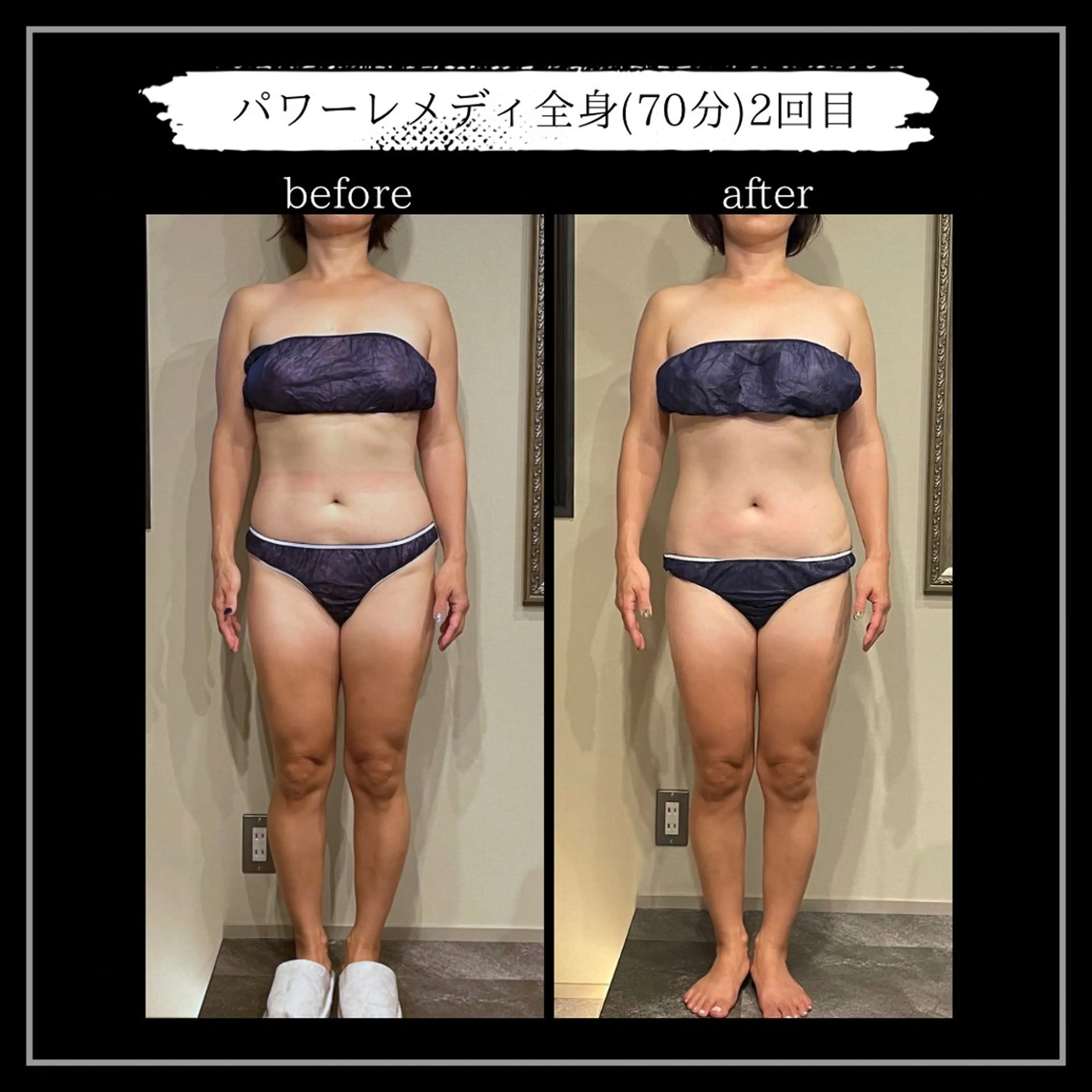 オフ:オン所属・オフ:オン 全身筋膜マッサージのエステ・リラクイメージ