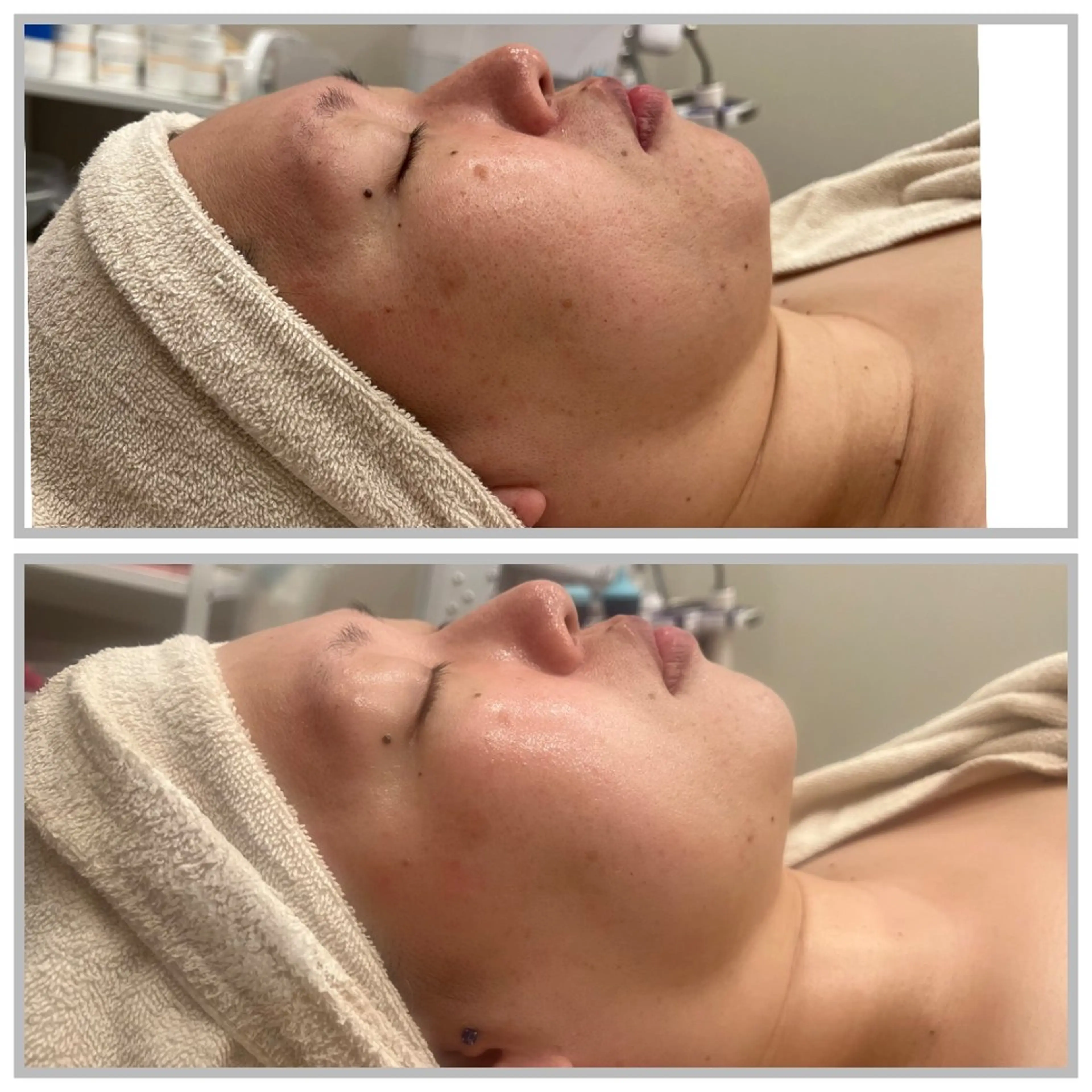 エステ ベル チェリカ 三城のエステ・リラクイメージ